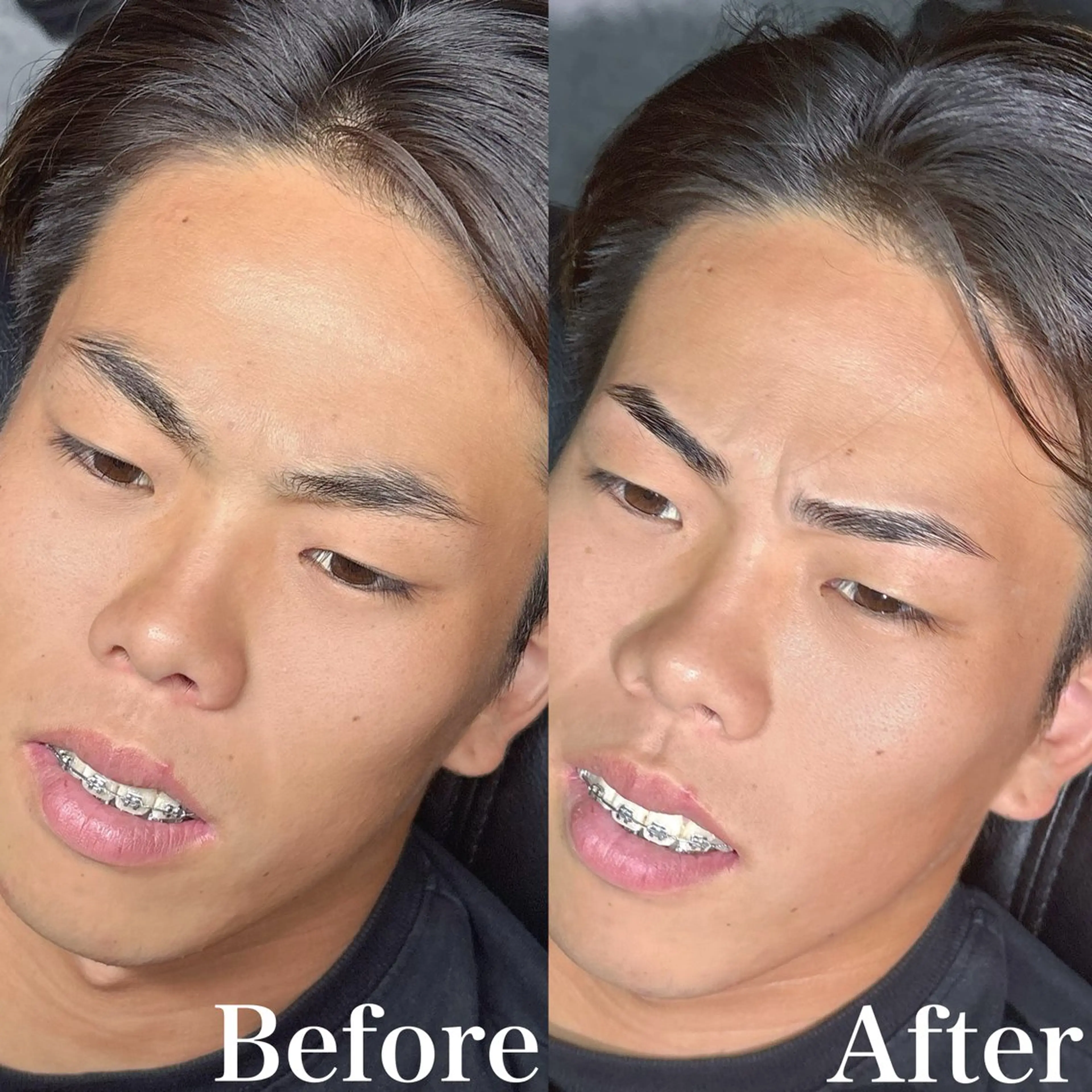 メンズ アイブロウ ワックス脱毛 眉カット その他(アイブロウ) 17◯Re:gid Yusukeの眉毛・アイブロウイメージ