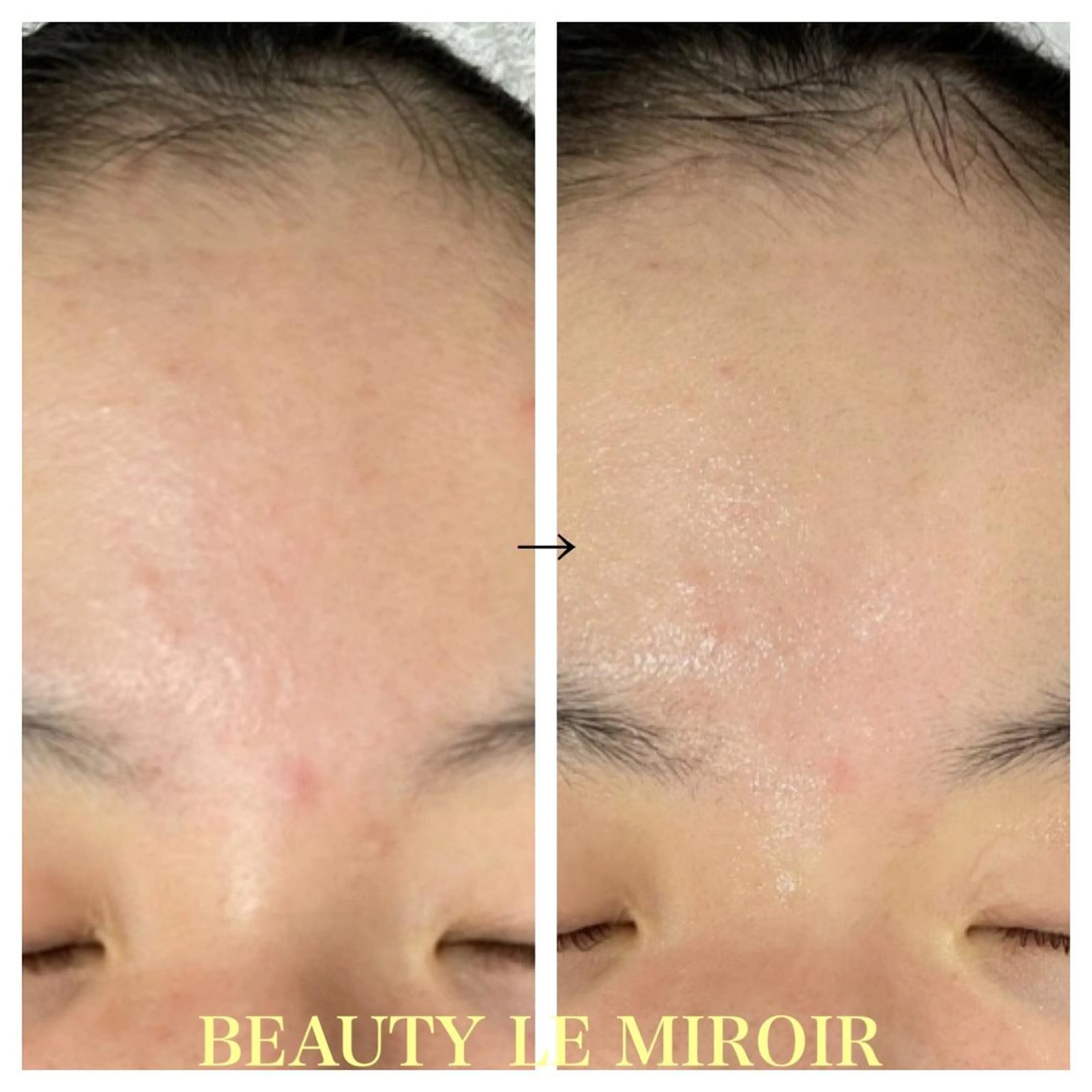 ビューティー ミロワールのエステ・リラクイメージ