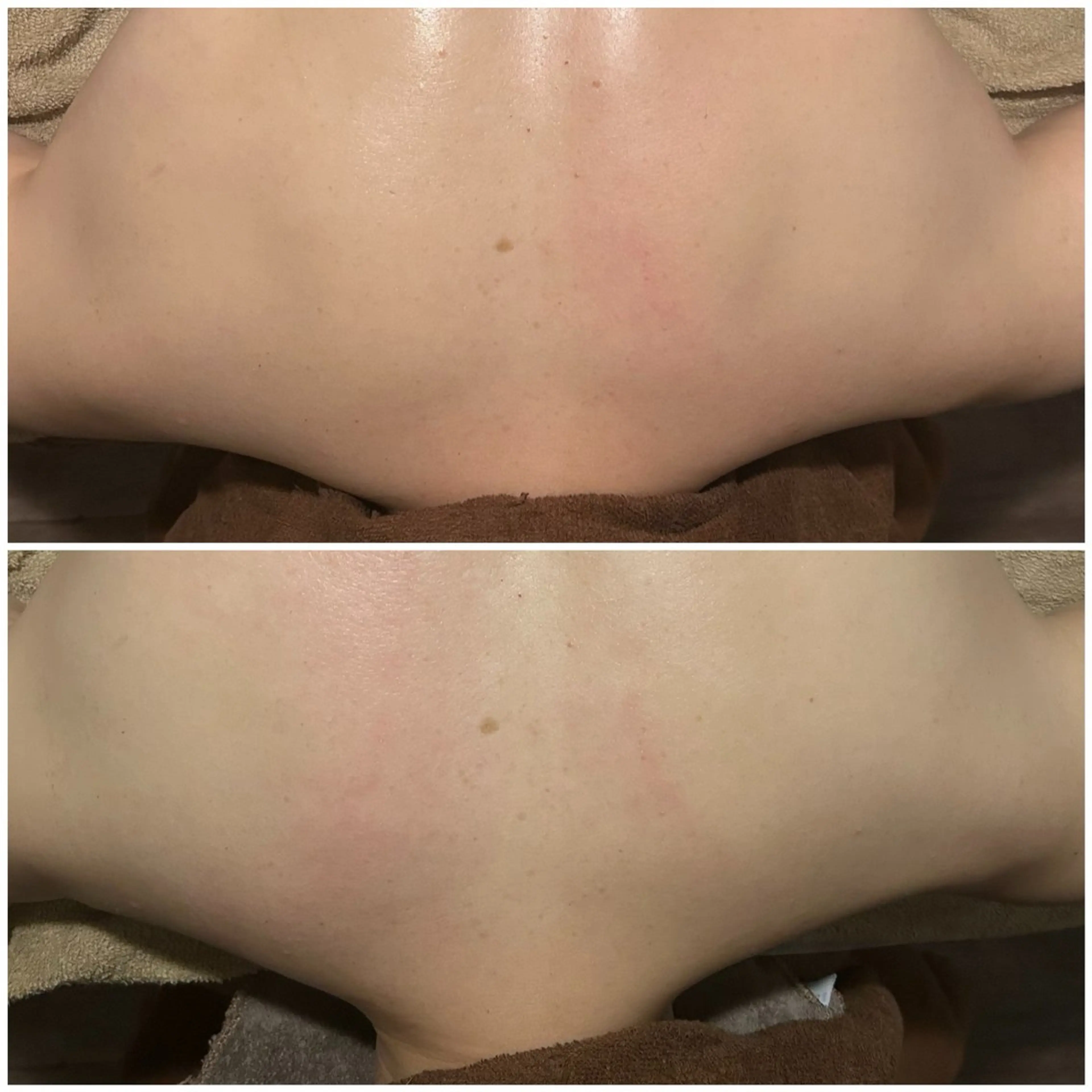 PIUMA 筋膜リリース・リンパのエステ・リラクイメージ