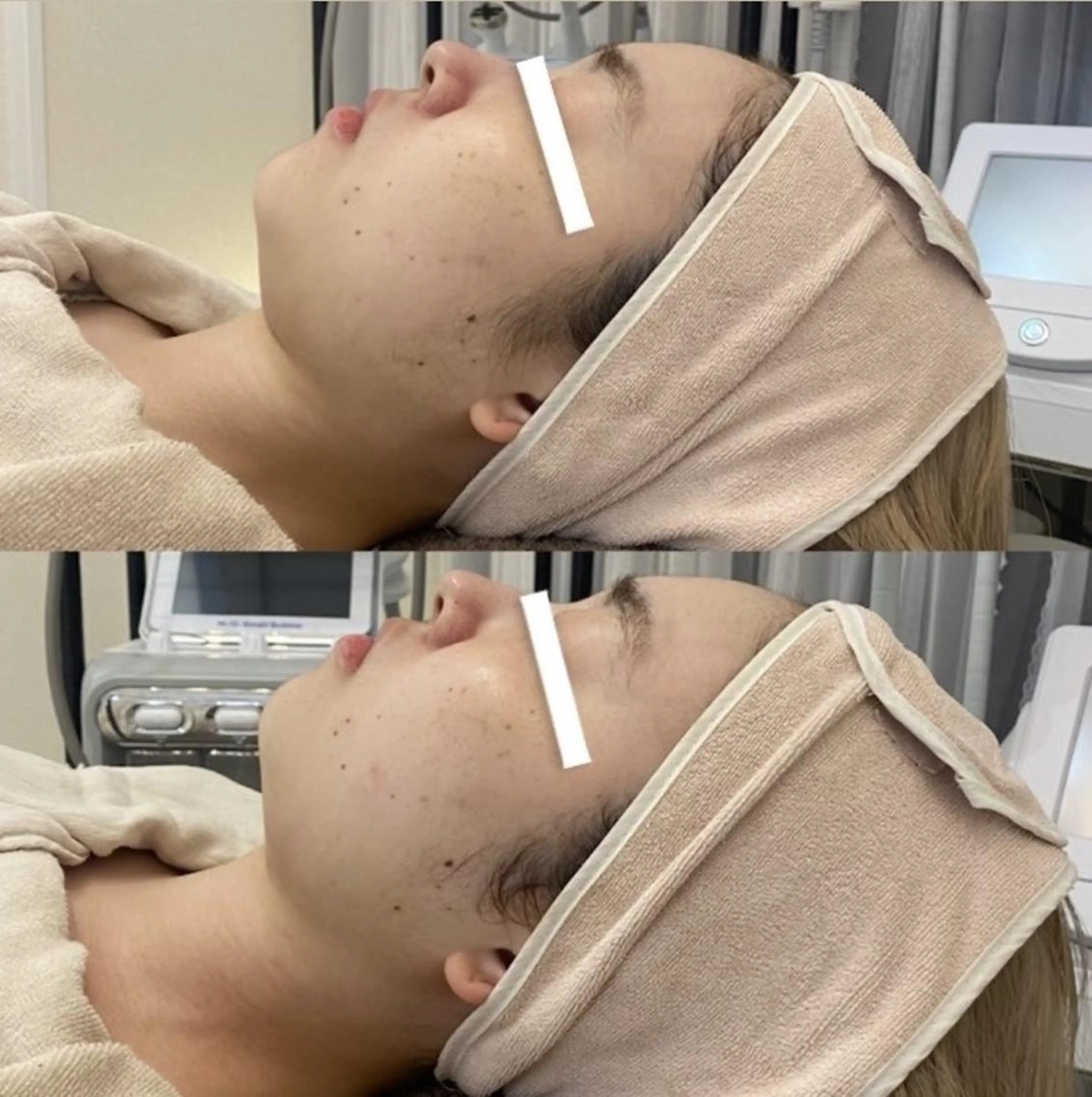 ✨美肌水光✨ アトリエリュバンのエステ・リラクイメージ