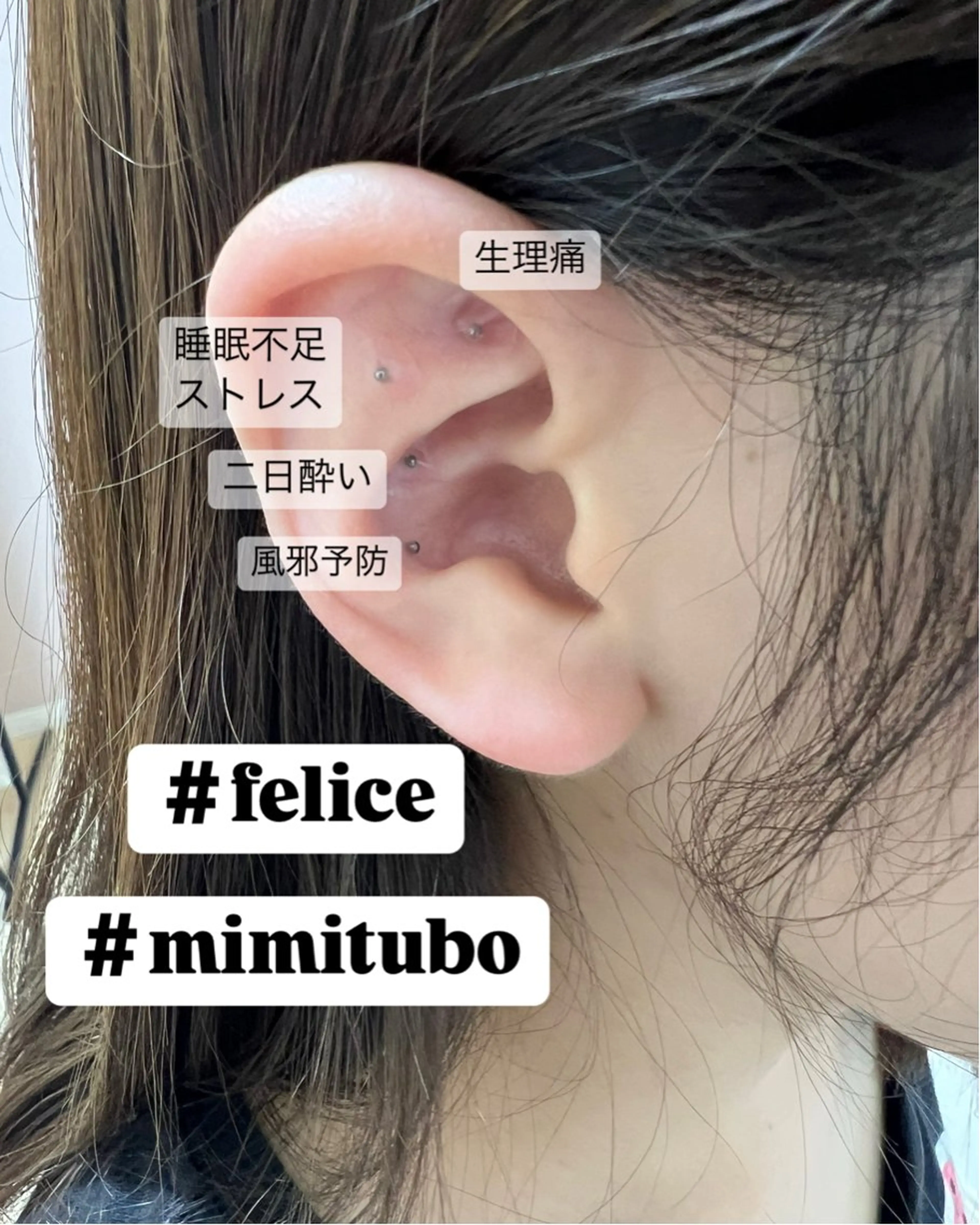 耳つぼ目立たないシールのみ　金粒、銀粒のみ　10粒までの写真