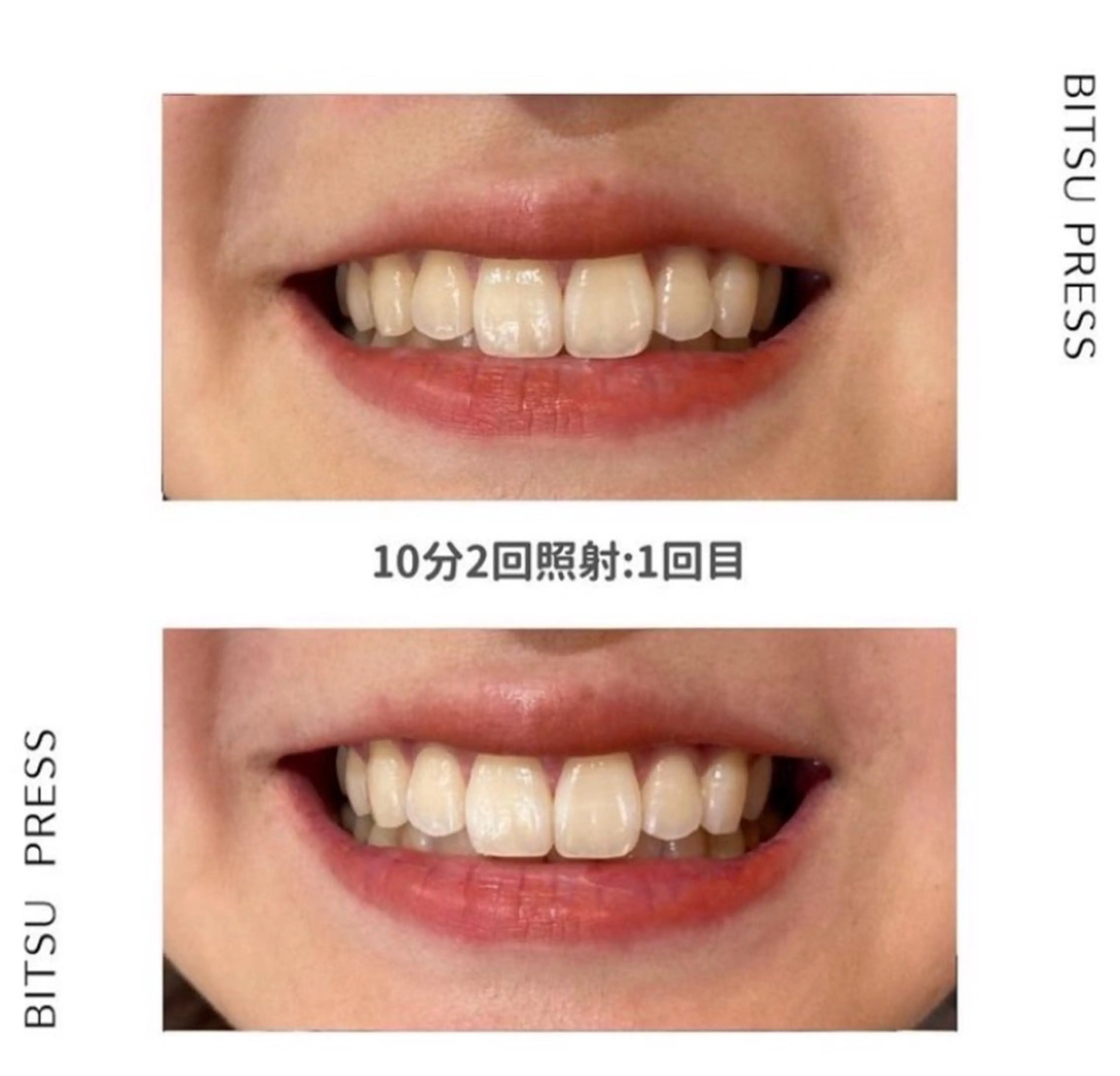 BITSU　PRESS原宿所属・PRESS 中山のエステ・リラクイメージ