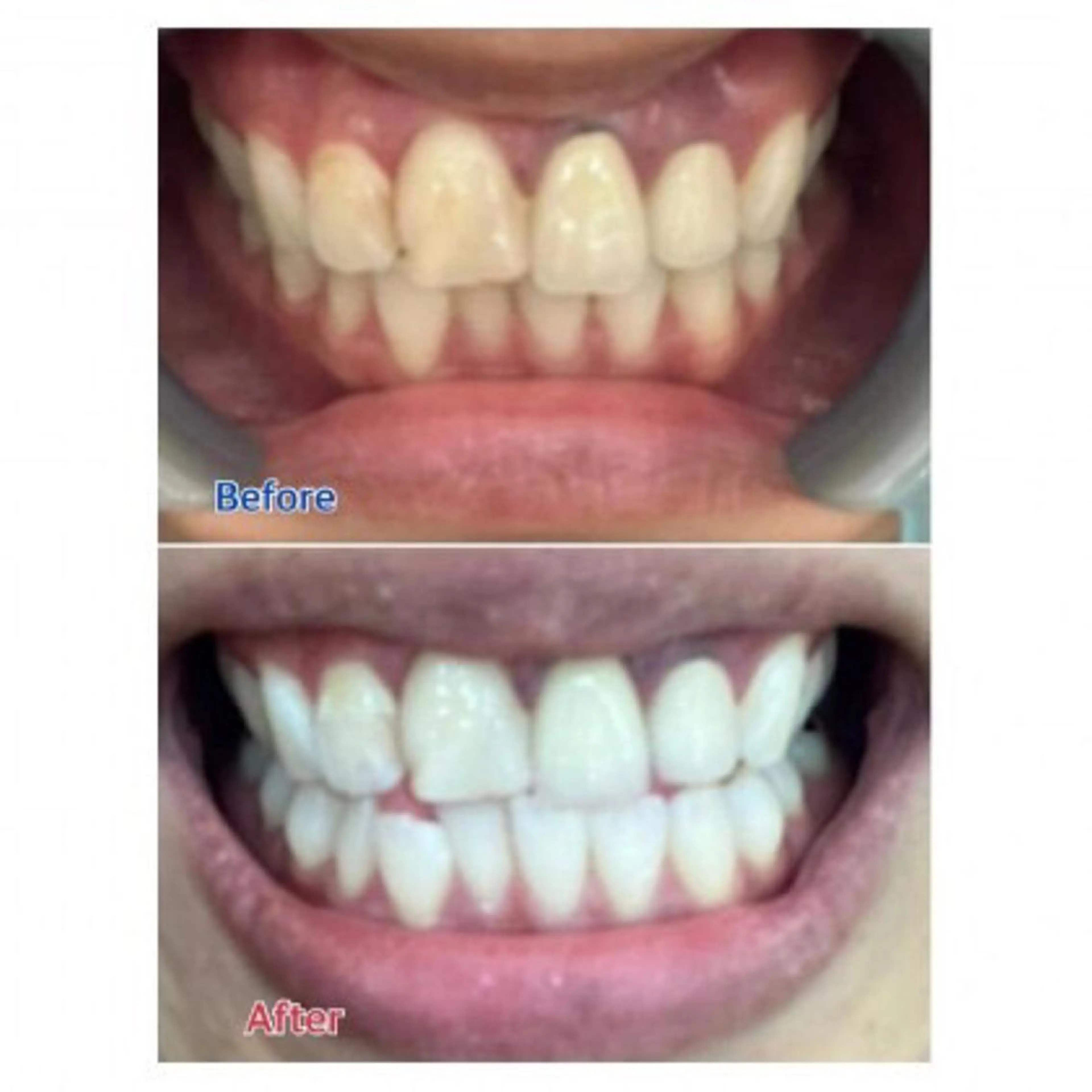 M渋谷店所属・Ｍ渋谷 ホワイトニングのエステ・リラクイメージ