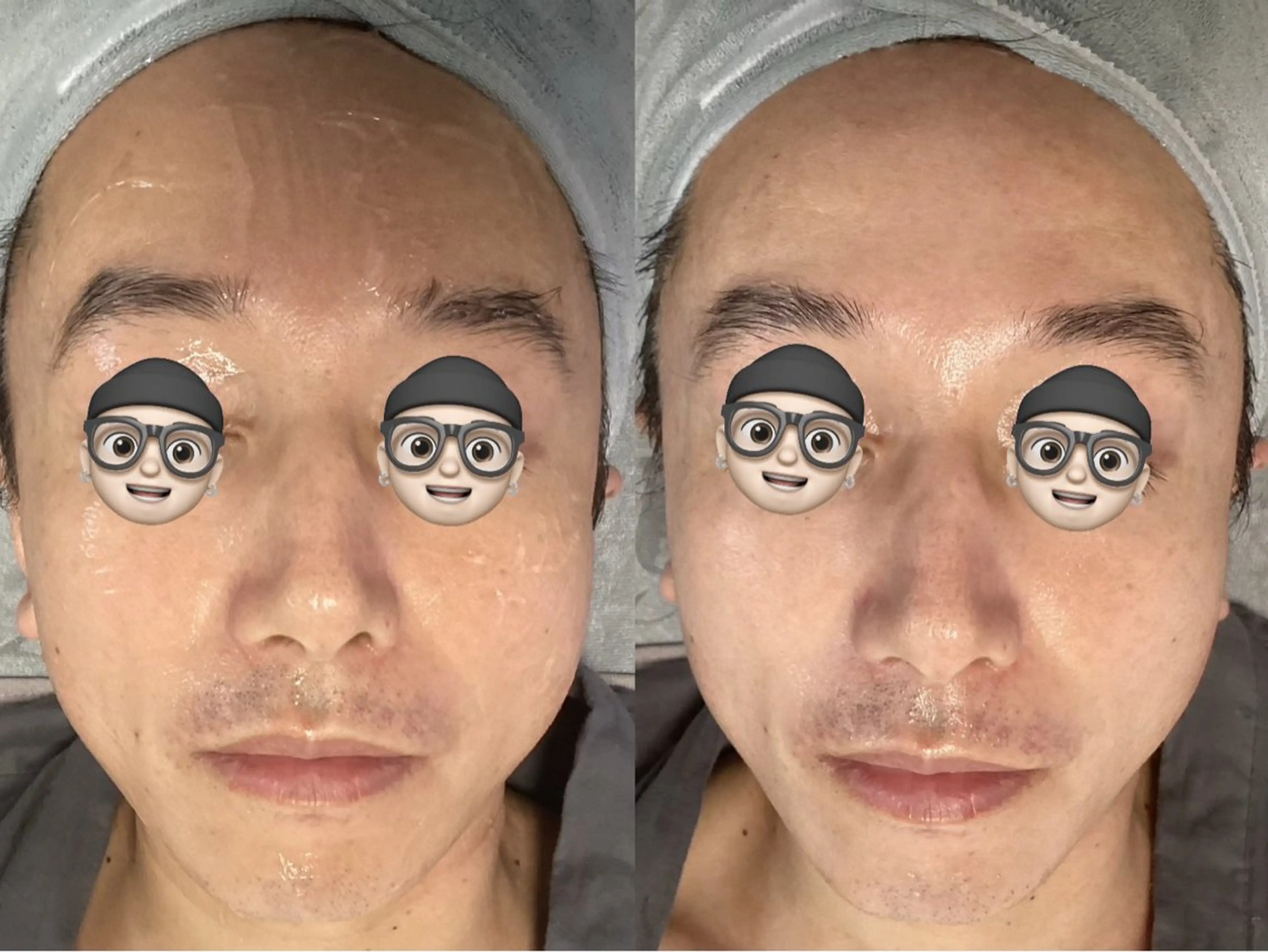 エステ リラク ホワイティアビシェル ウラワ　白澤奇のその他イメージ