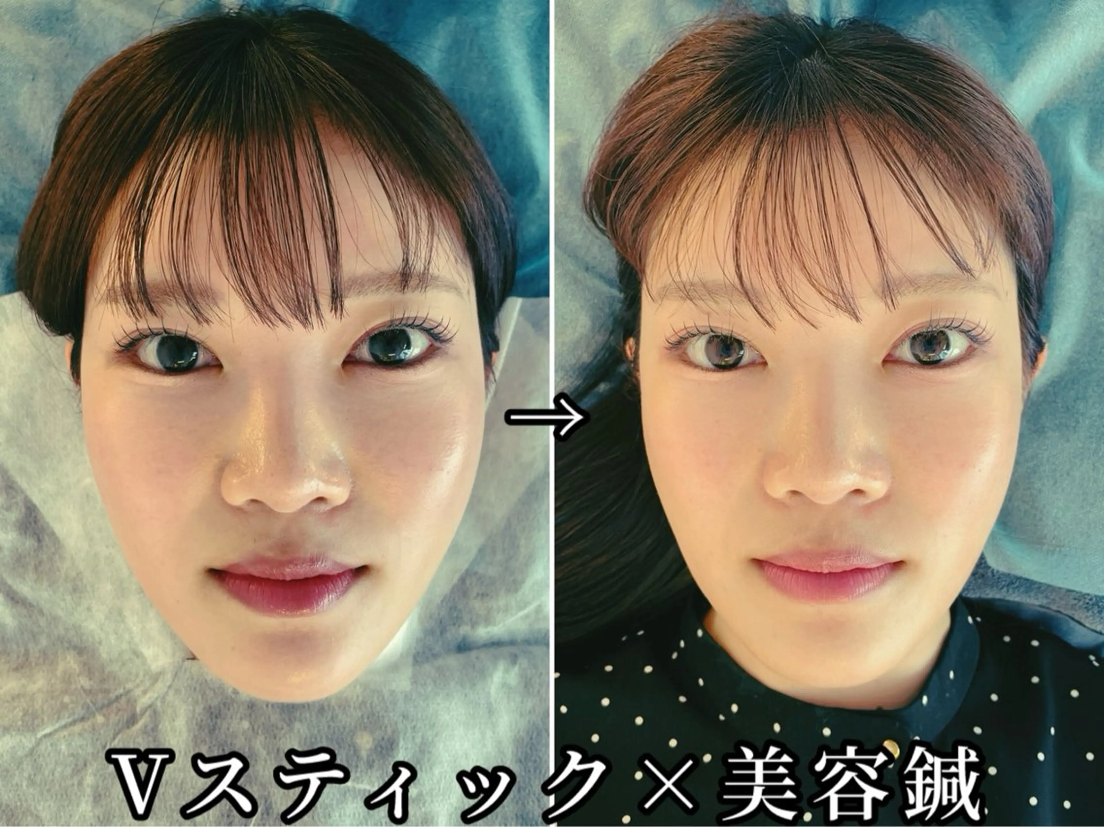 エステ リラク 渋谷 小顔美容鍼 専門サロン YZのエステ・リラクイメージ