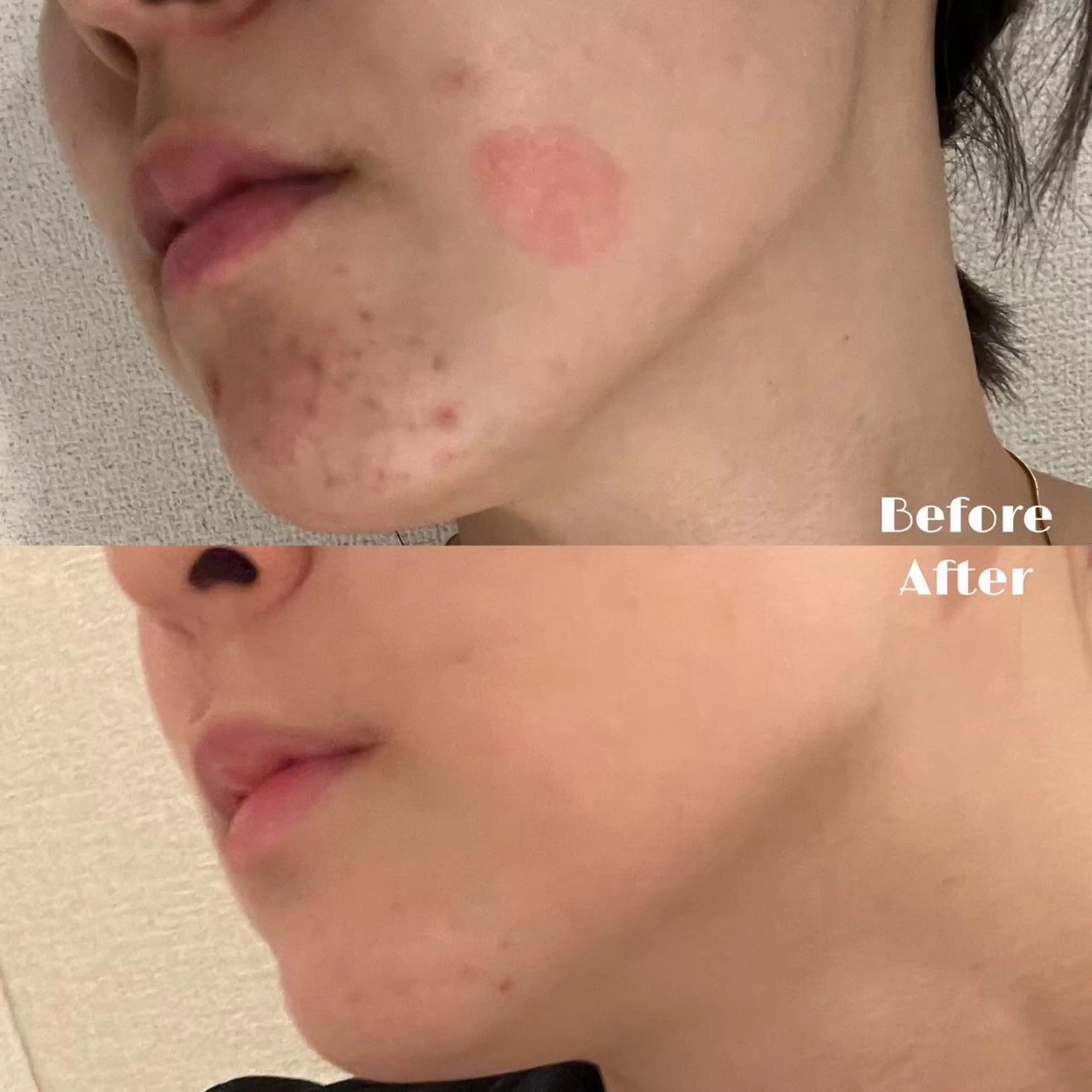 # fu♡のエステ・リラクイメージ