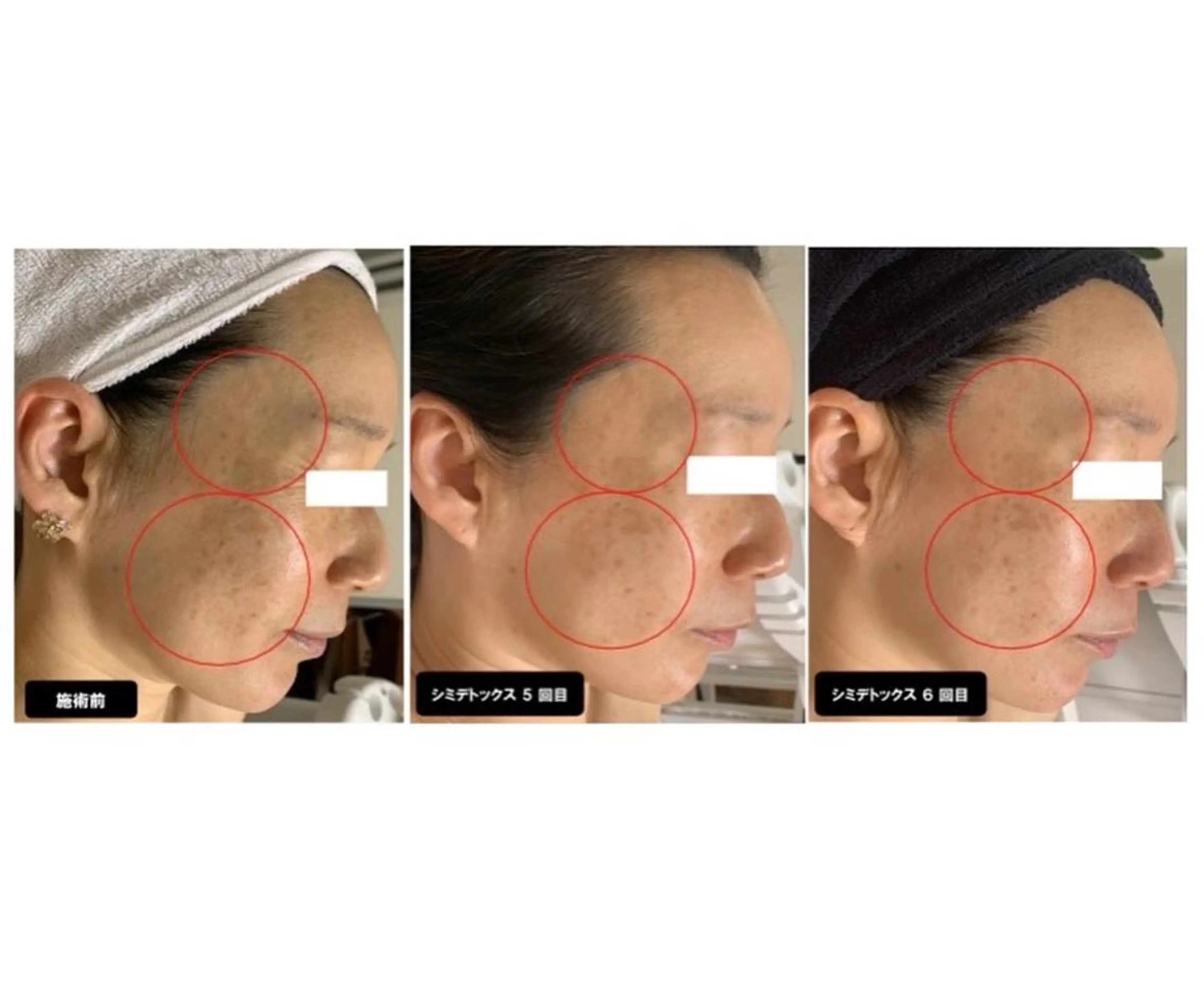 エステ ヴィーナス ビューティーのエステ・リラクイメージ