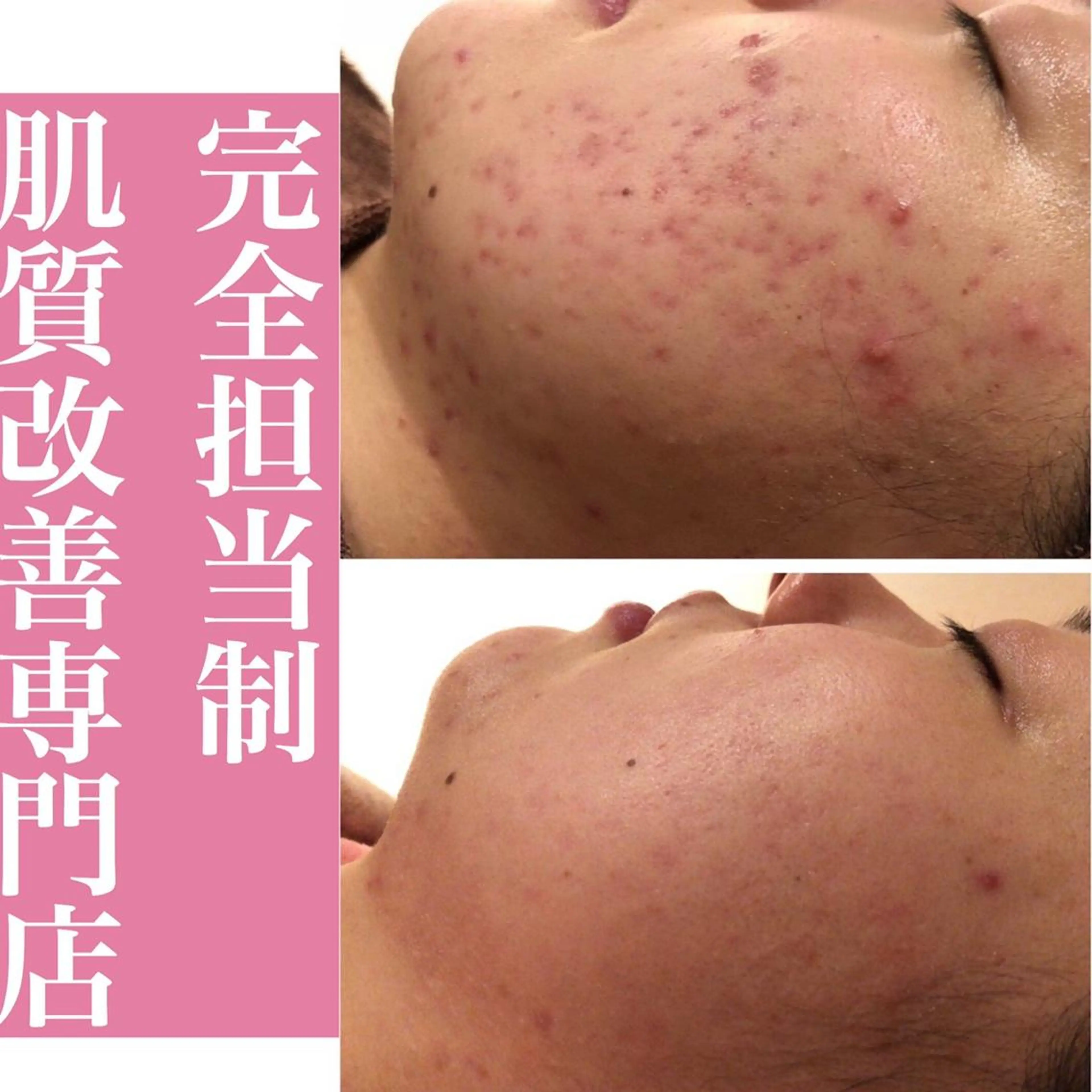 ミディアム カラー パーマ ヘアアレンジ メンズ キッズ ネイル マツエク・マツパ エステ リラク ニキビ・肌質改善専門 ♡人生が変わるサロンのエステ・リラクイメージ