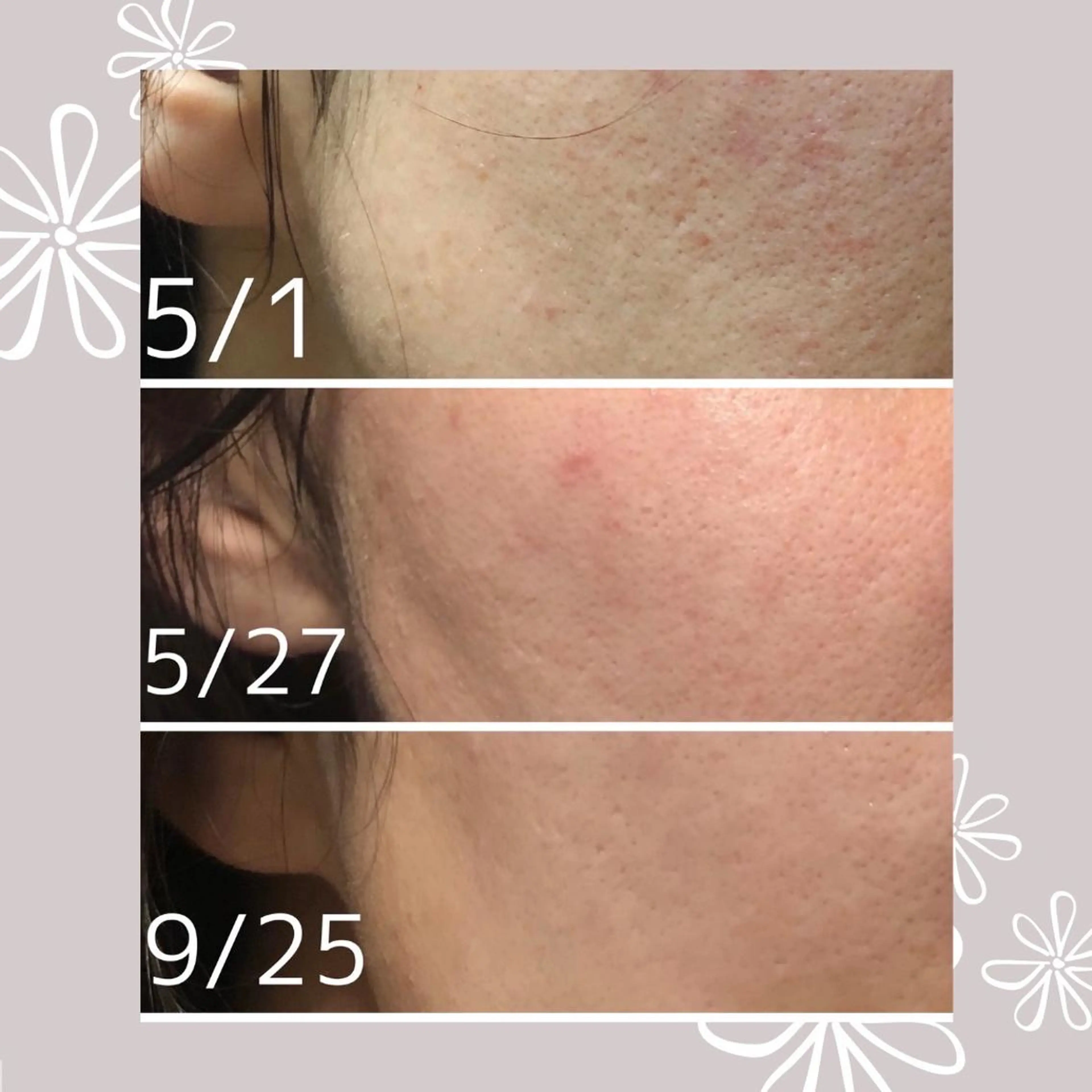 プライベート脱毛 Jr久宝寺のエステ・リラクイメージ