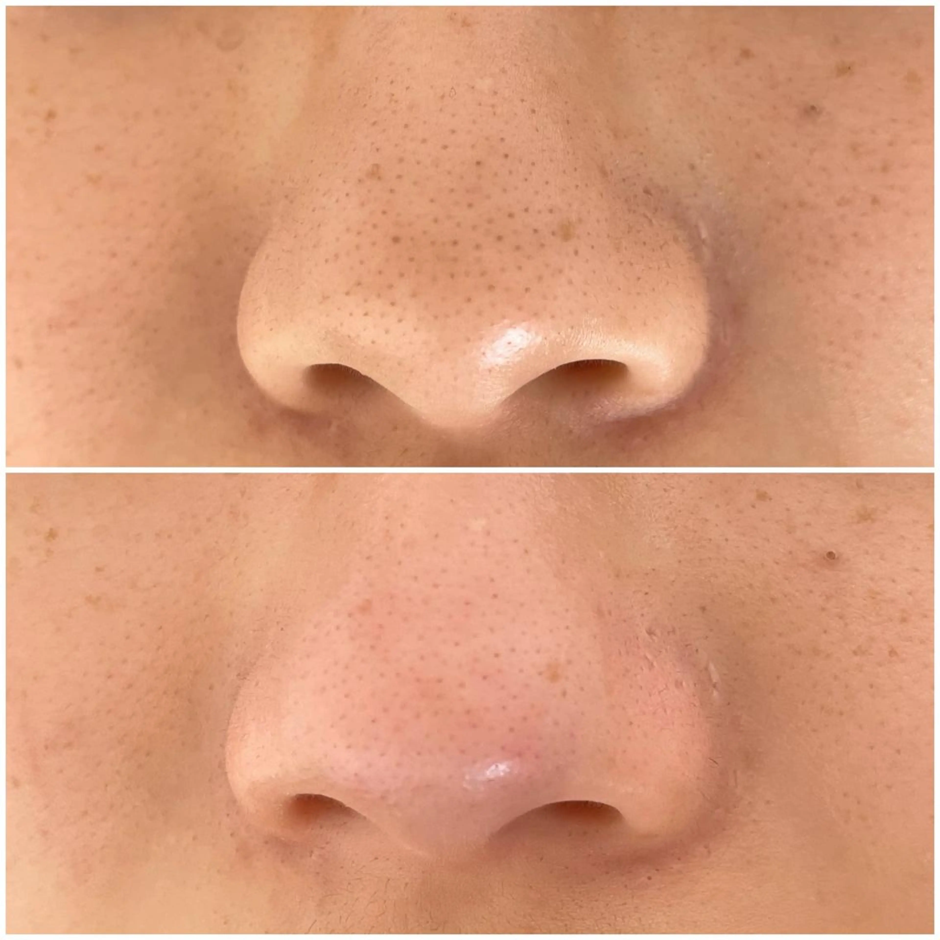 Eyelash salon MORE(モア)所属・安納 麻穂のエステ・リラクイメージ