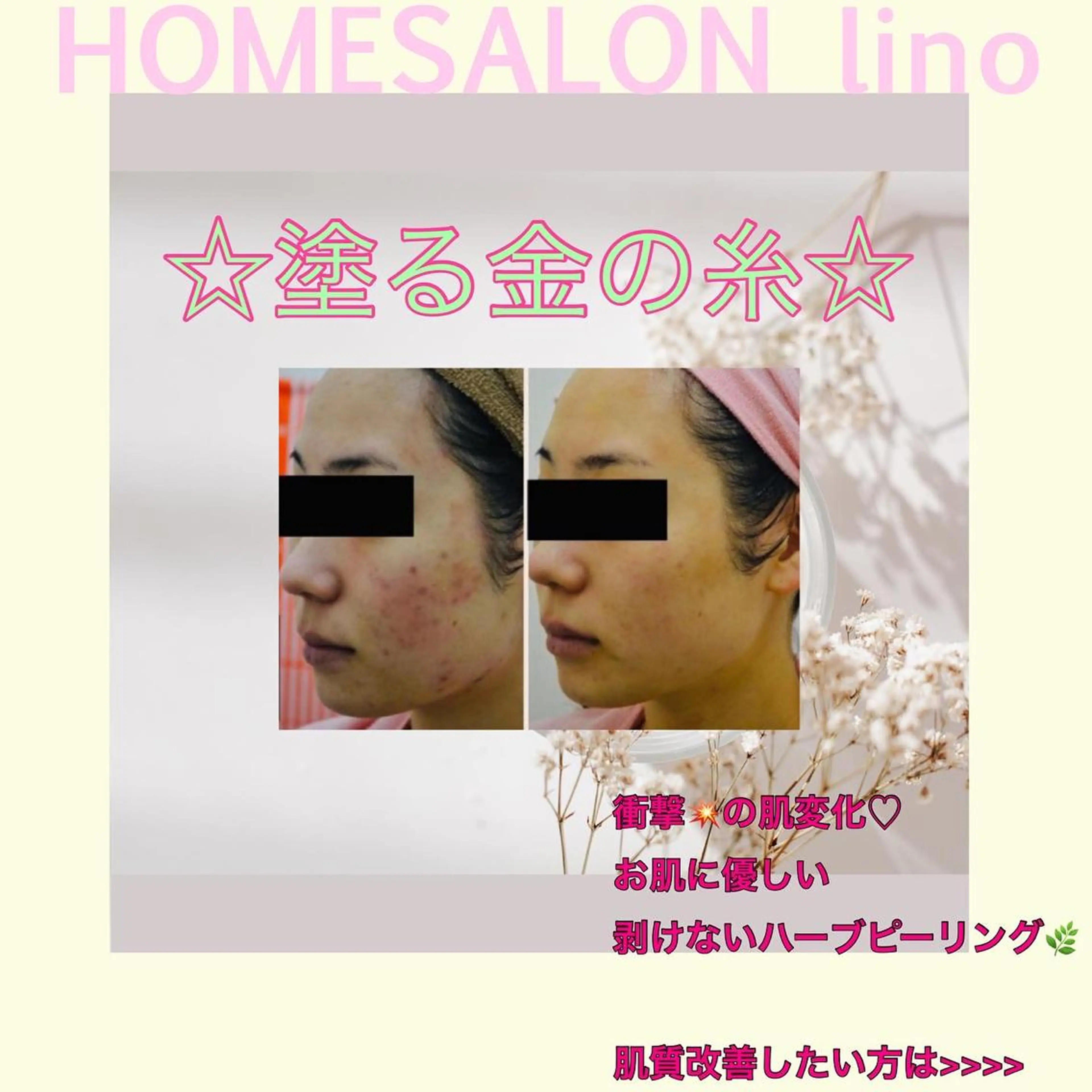 エステ HOME SALON linoのエステ・リラクイメージ