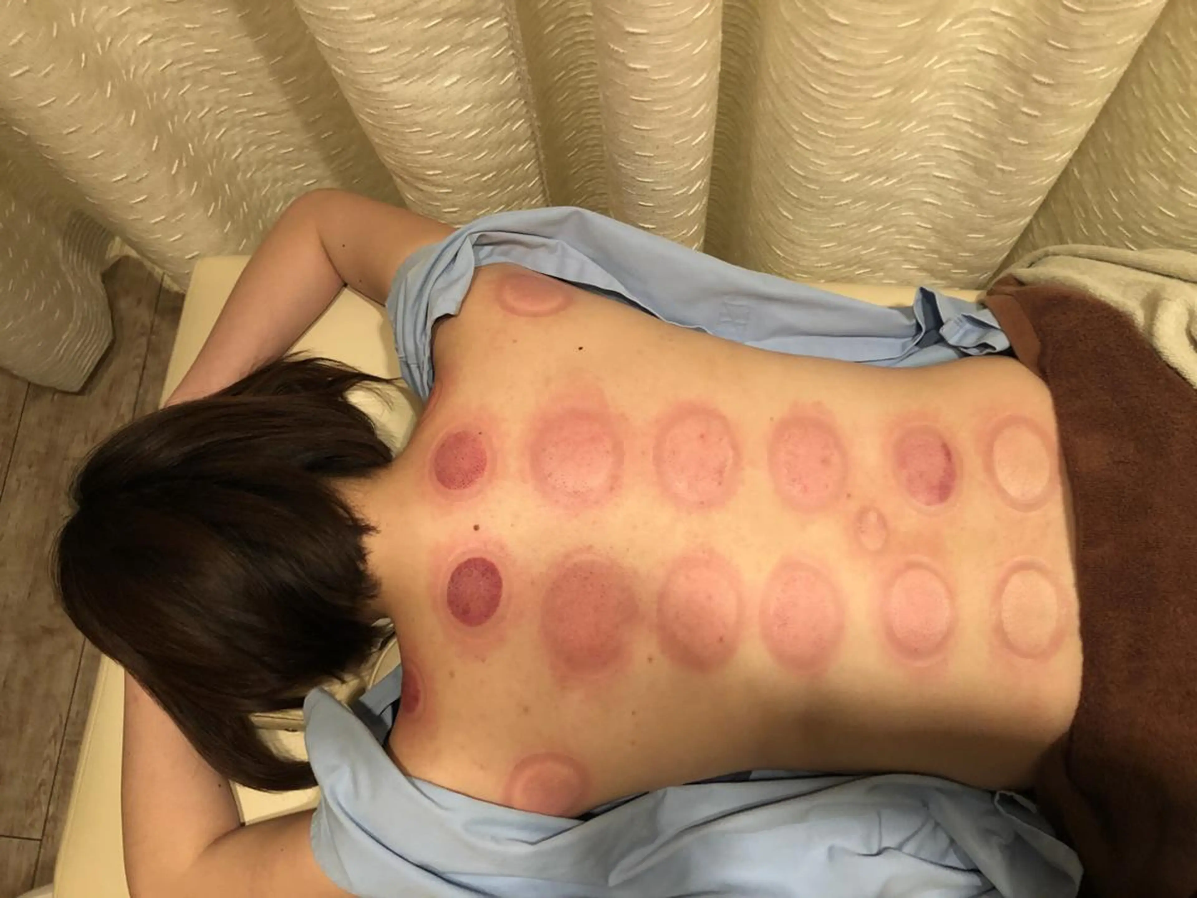 むくみたるみ専門☆ 美容鍼・小顔矯正のエステ・リラクイメージ