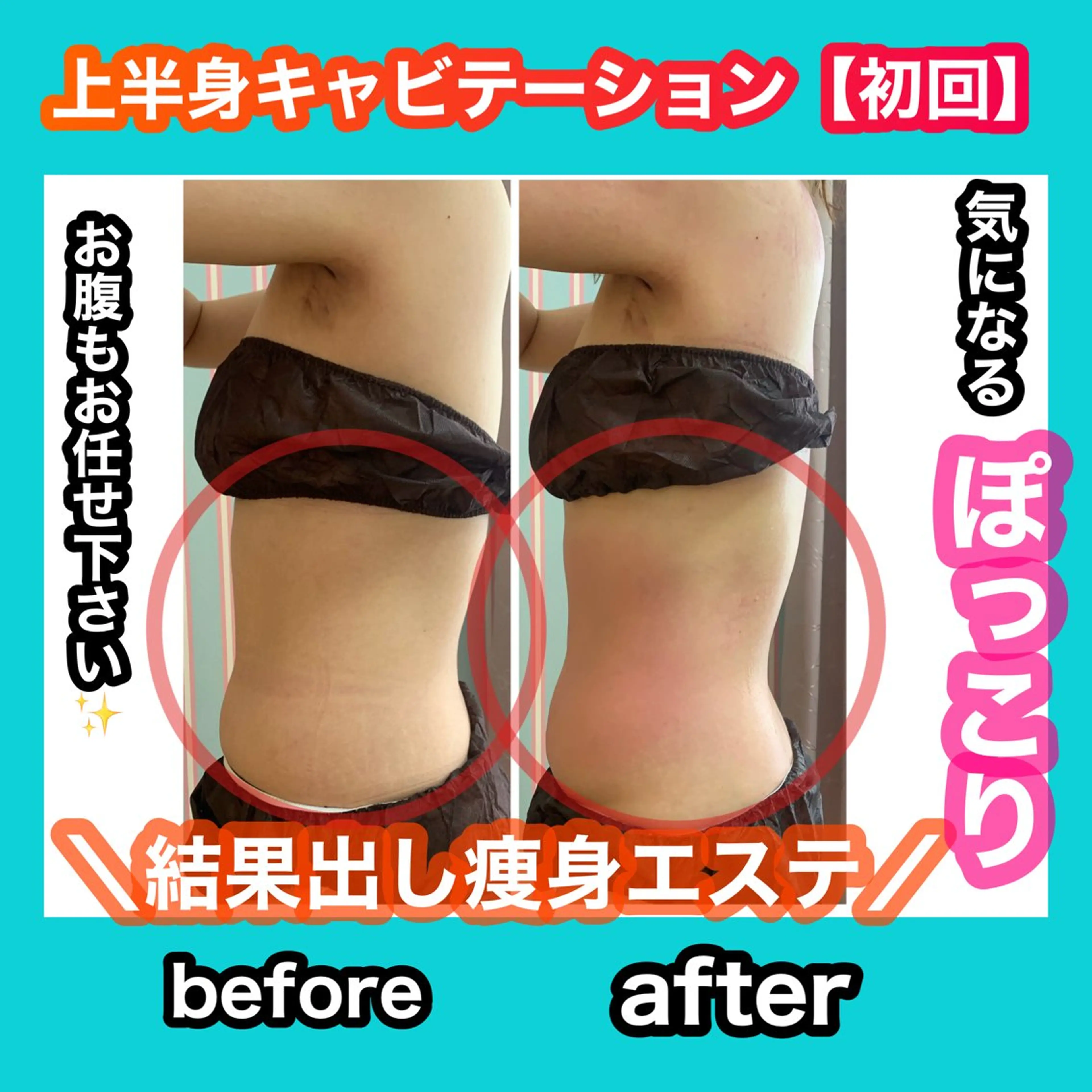 エステ リラク 痩身/脱毛/ネイル HARUKAのエステ・リラクイメージ