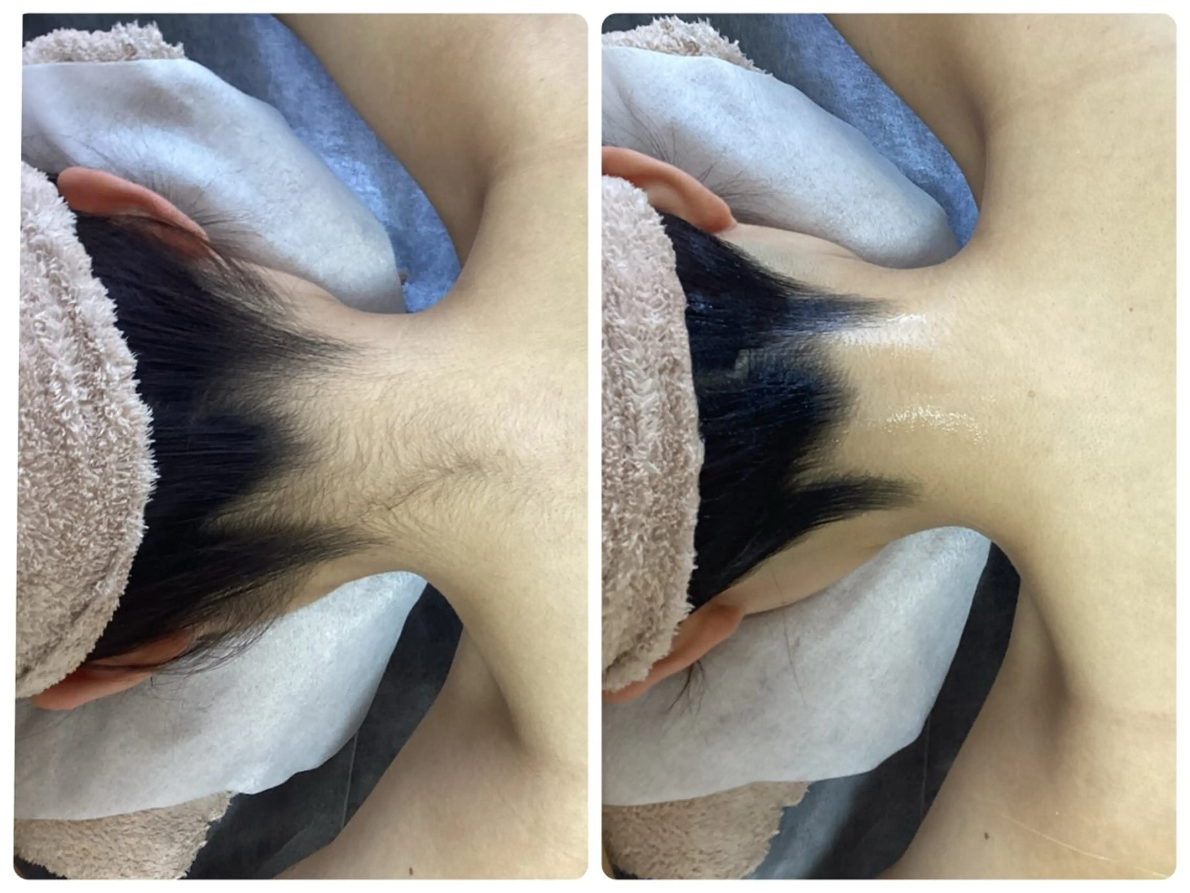 脱毛 脱毛専門減毛サロン LULU.tokyoのエステ・リラクイメージ