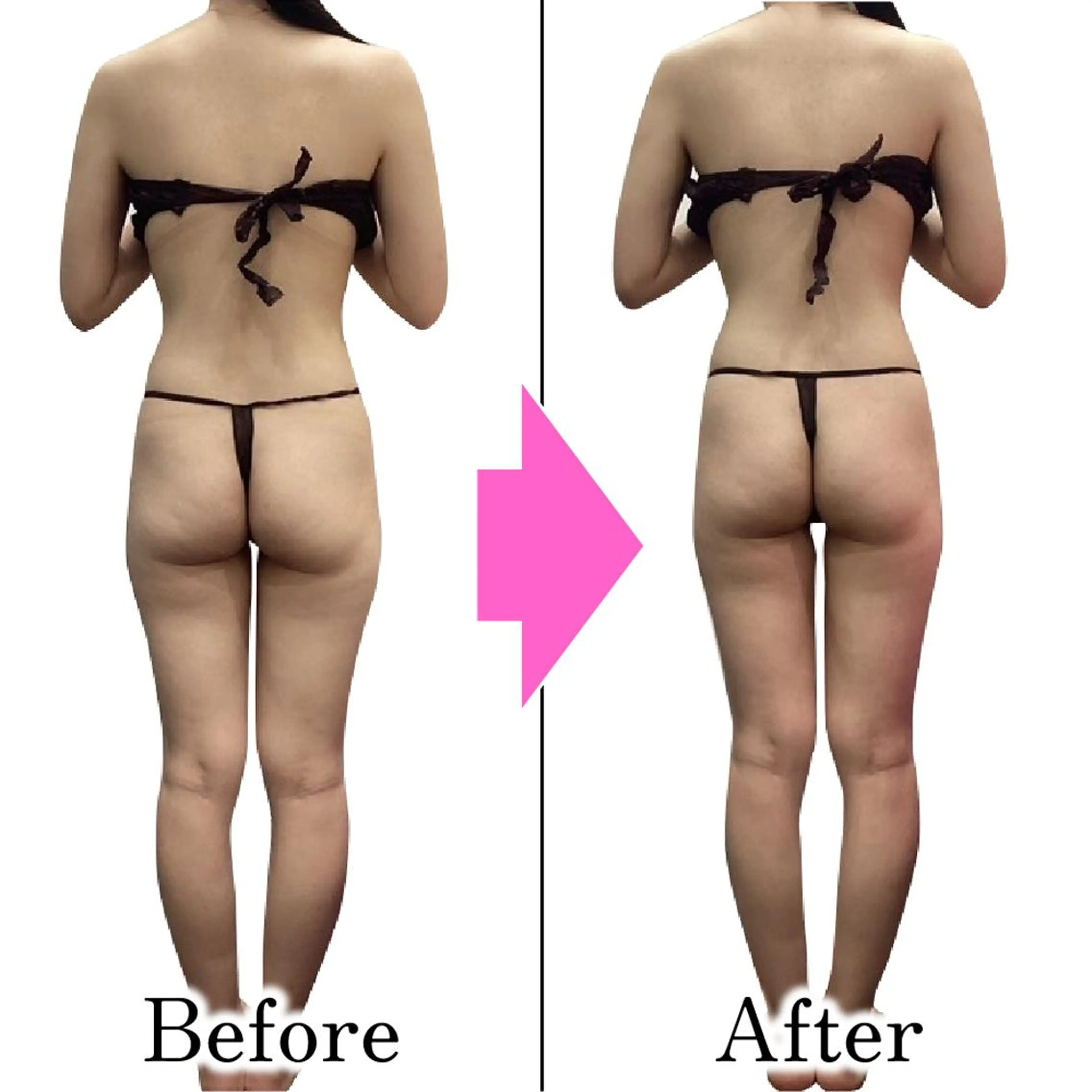 エステ ダイエットラボ梅田店 🌟のエステ・リラクイメージ