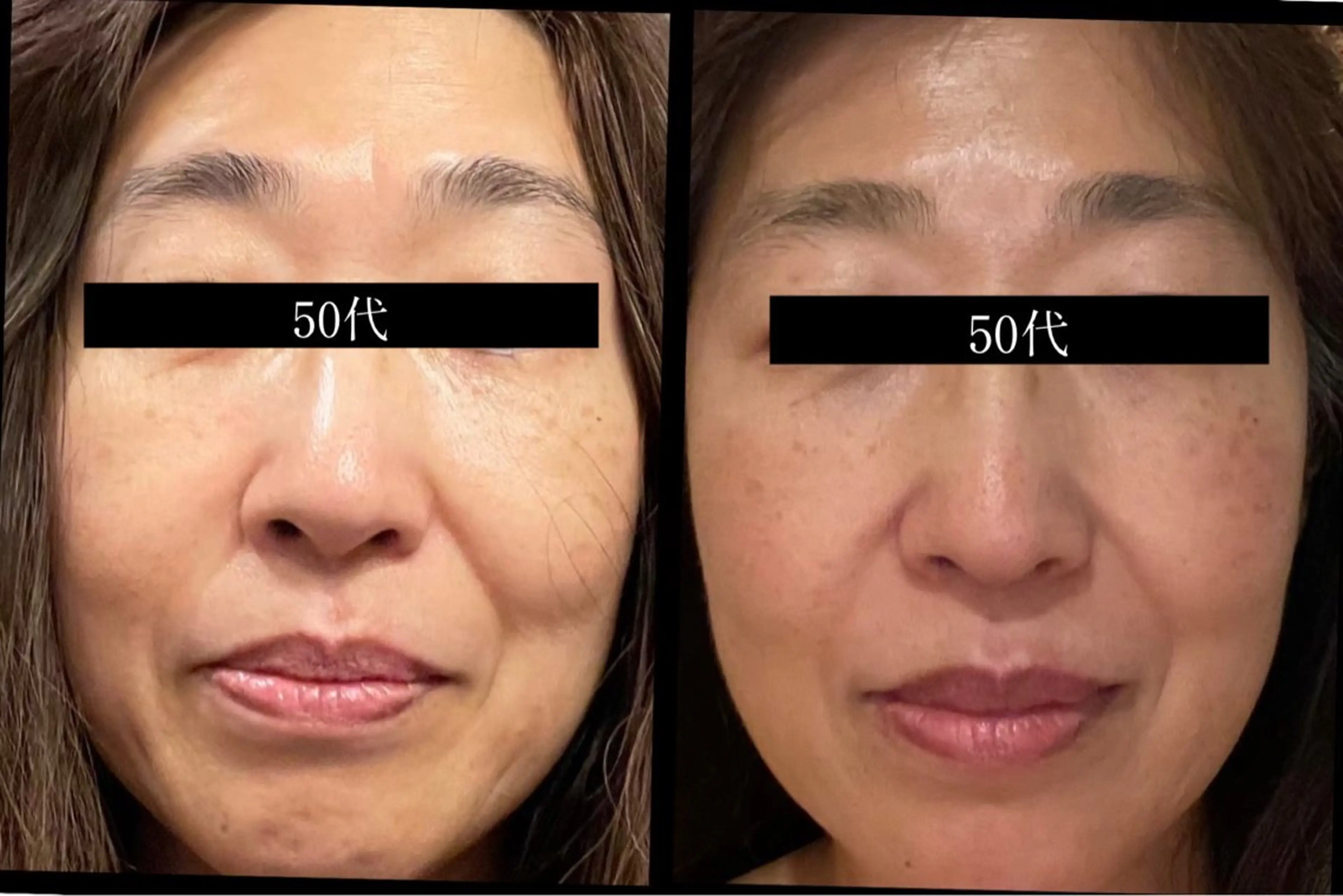 エステ リラク 夜エステサロン🌷Luana所属・夜サロン♡ Luana🦋.*˚のエステ・リラクイメージ