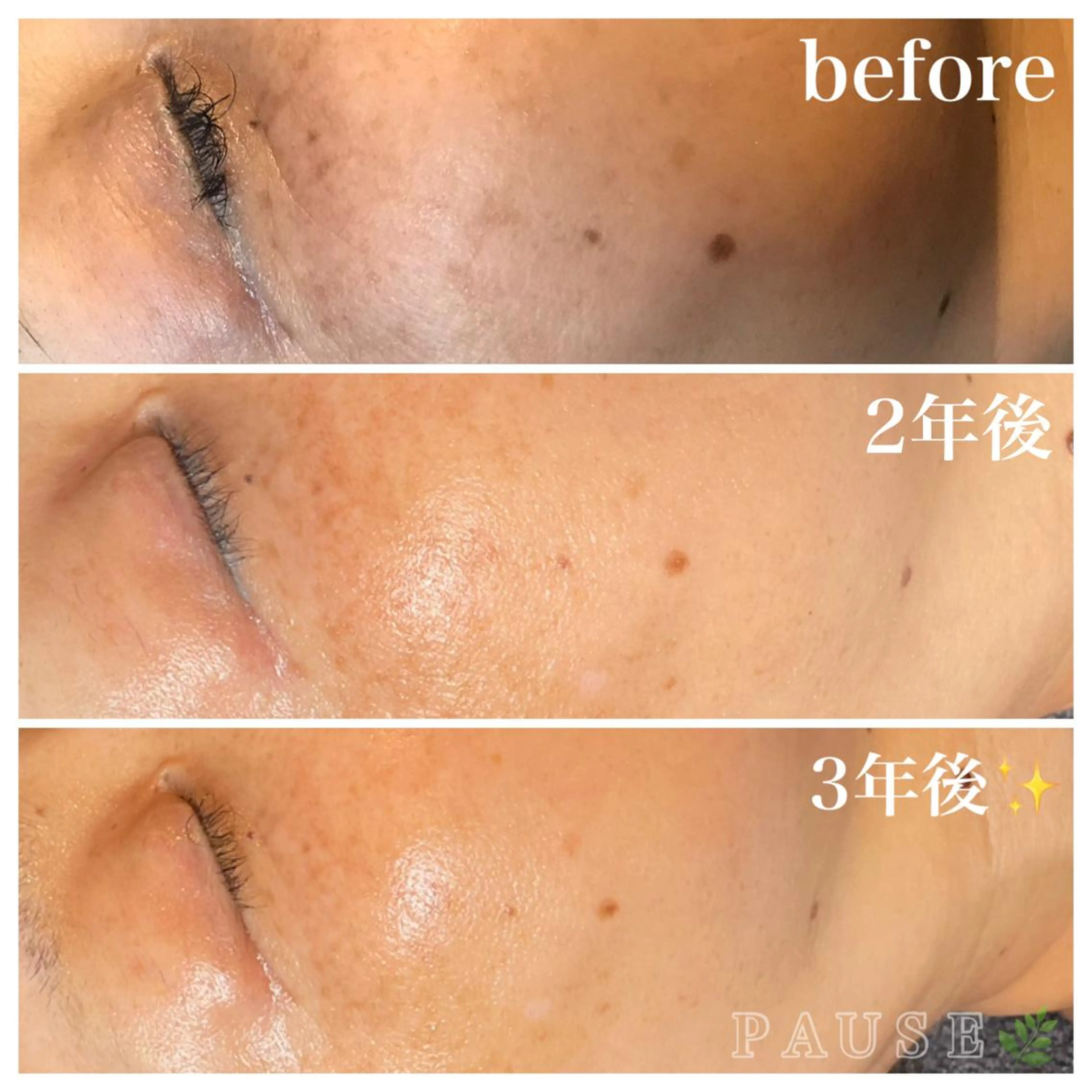 エステ 浜野 恵美のエステ・リラクイメージ