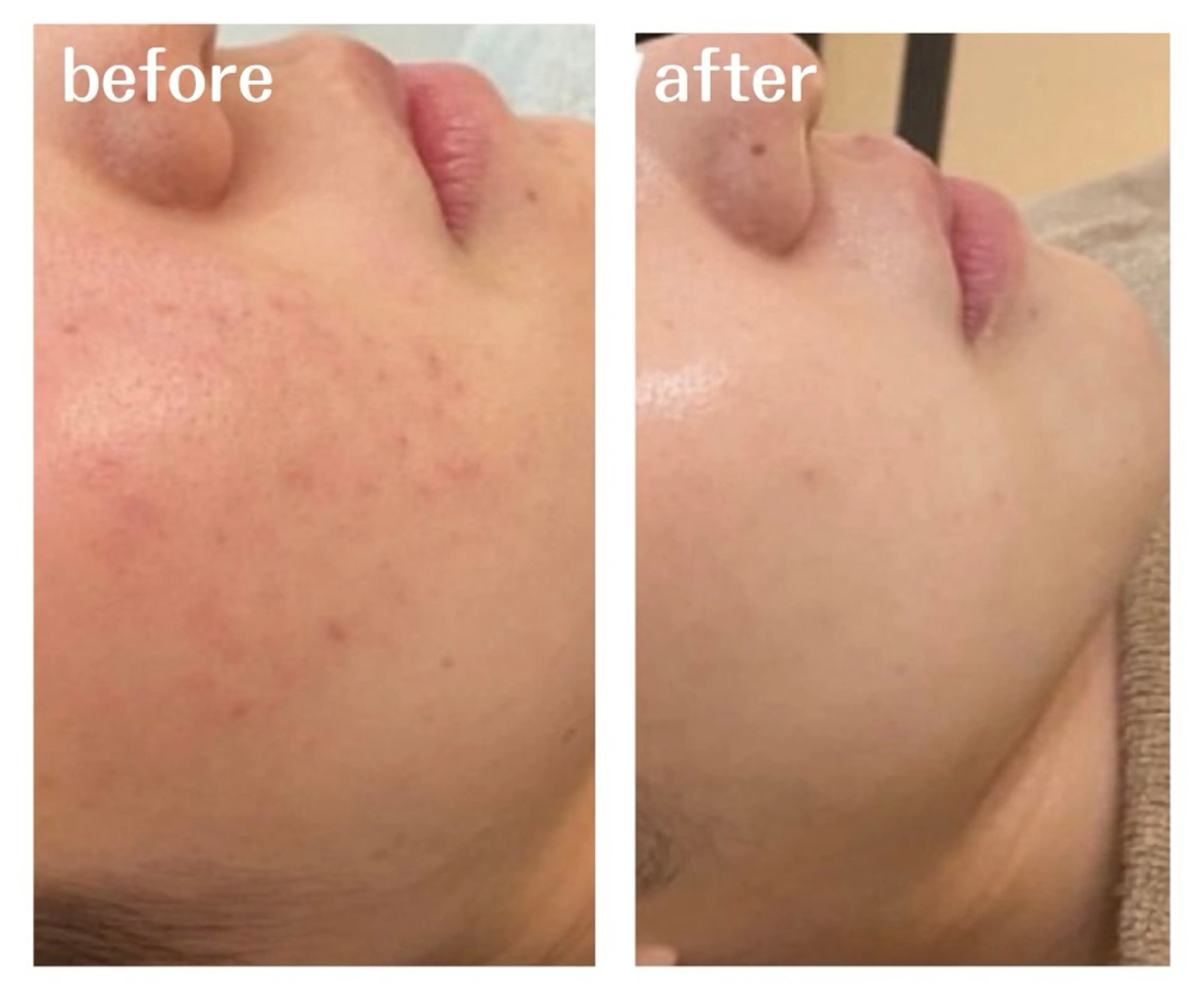 エステ aimee　肌質改善サロン【アイミー】所属・肌質改善サロン aimee｜アイミーのエステ・リラクイメージ