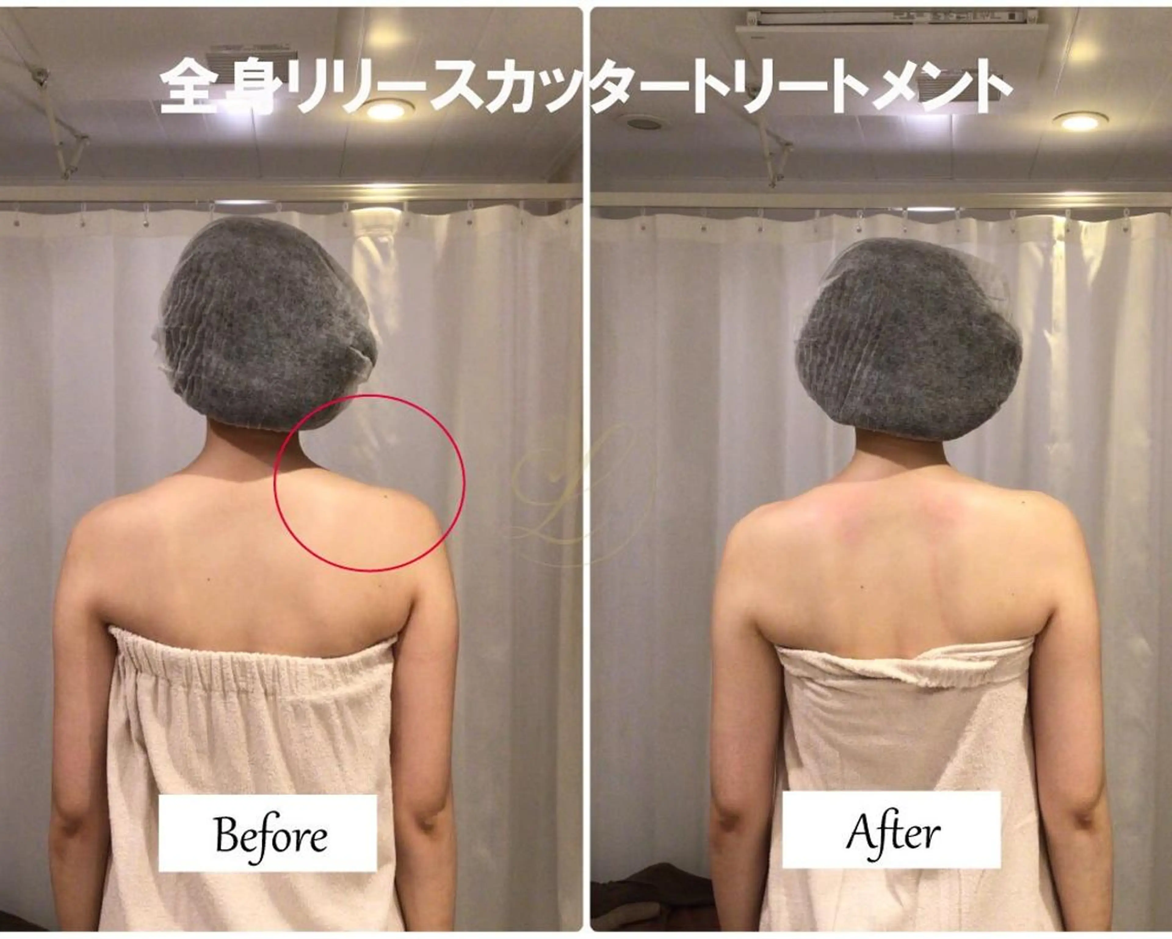 ブライダルサロン ｜Lino【堀江】のエステ・リラクイメージ