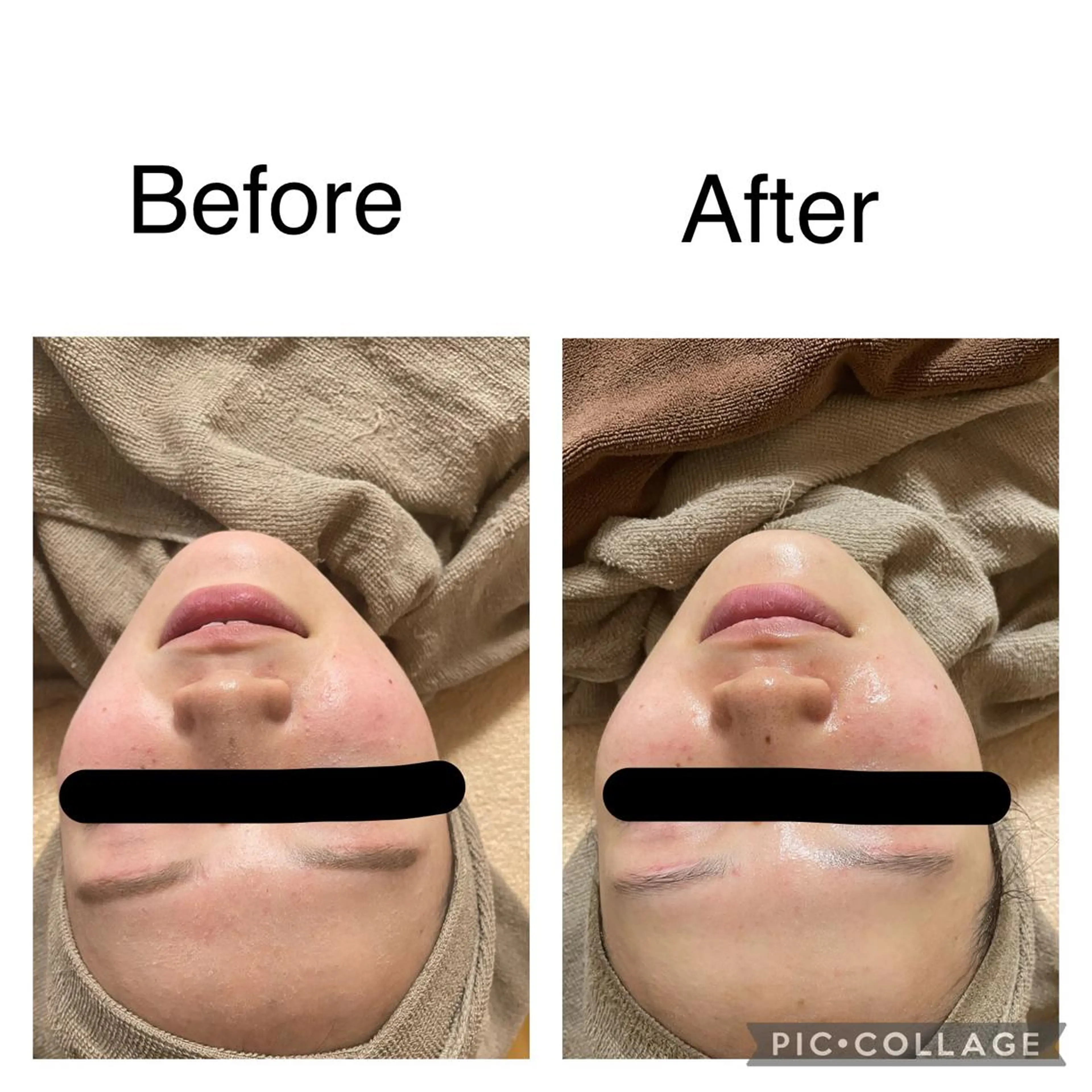 エステ リラク ECXIA ｴｸｼｱのエステ・リラクイメージ