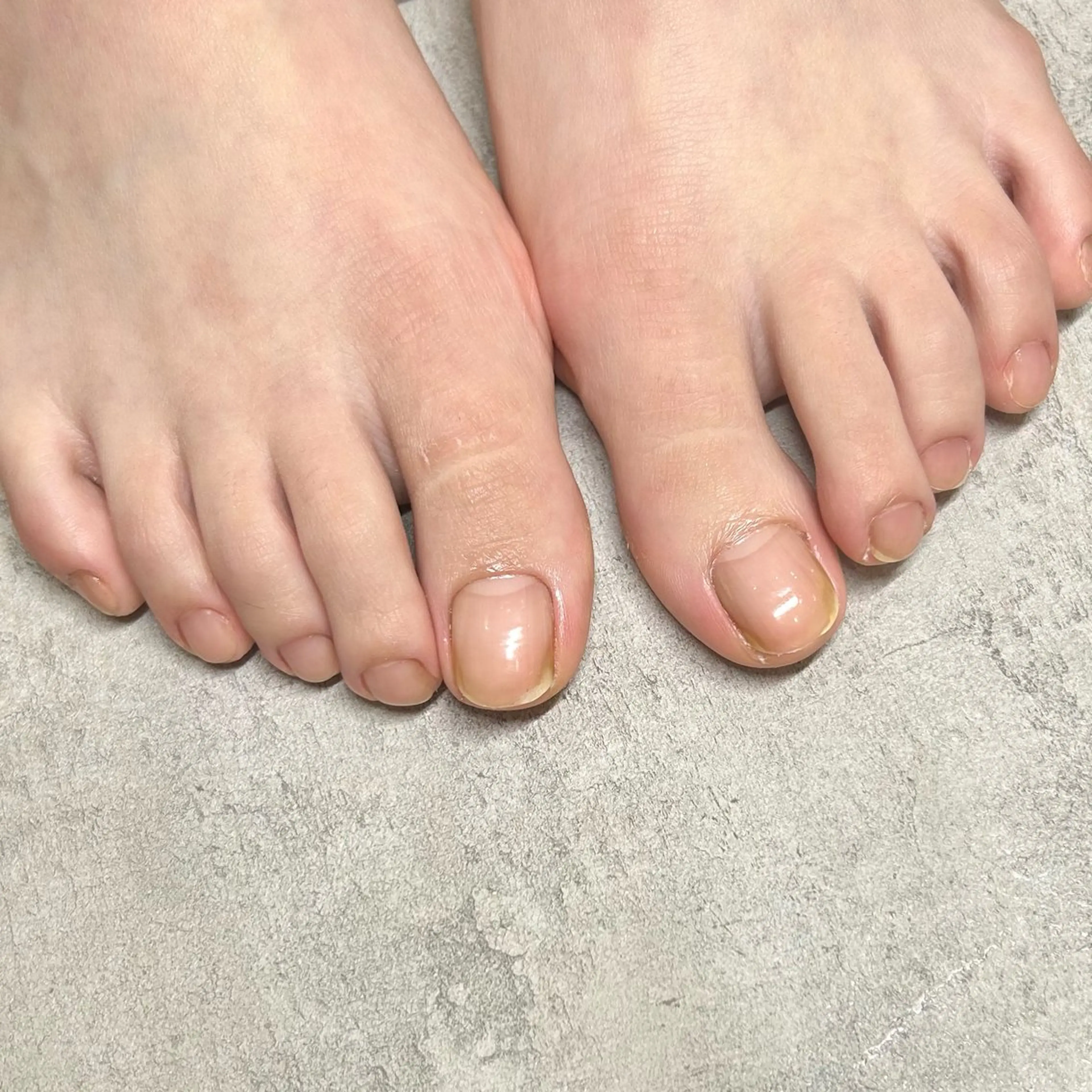 フットネイルケア🌱(ツヤだし)の写真