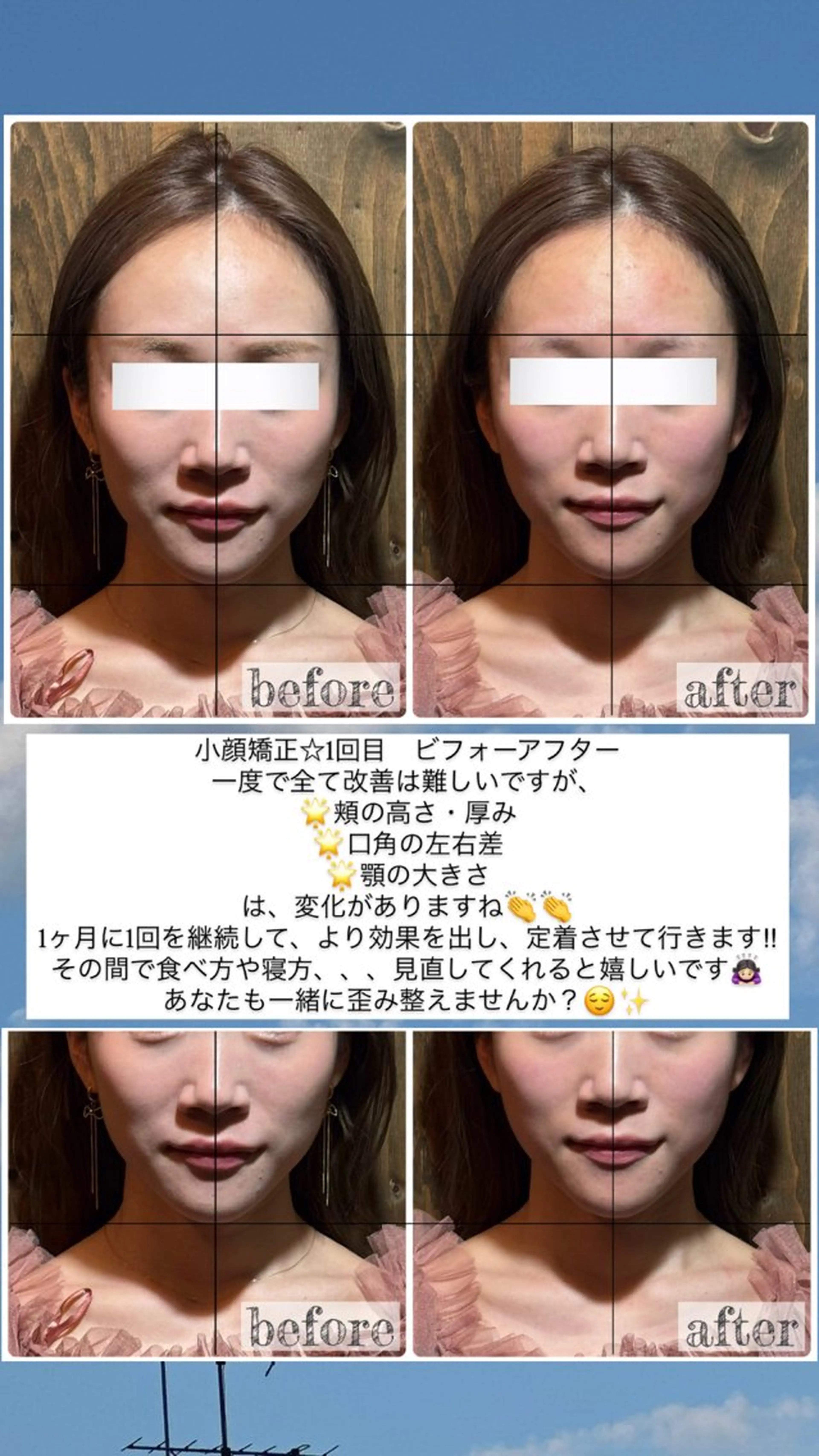 エステ リラク 💎後悔させない小顔 矯正💎イトヤマ🌱のエステ・リラクイメージ