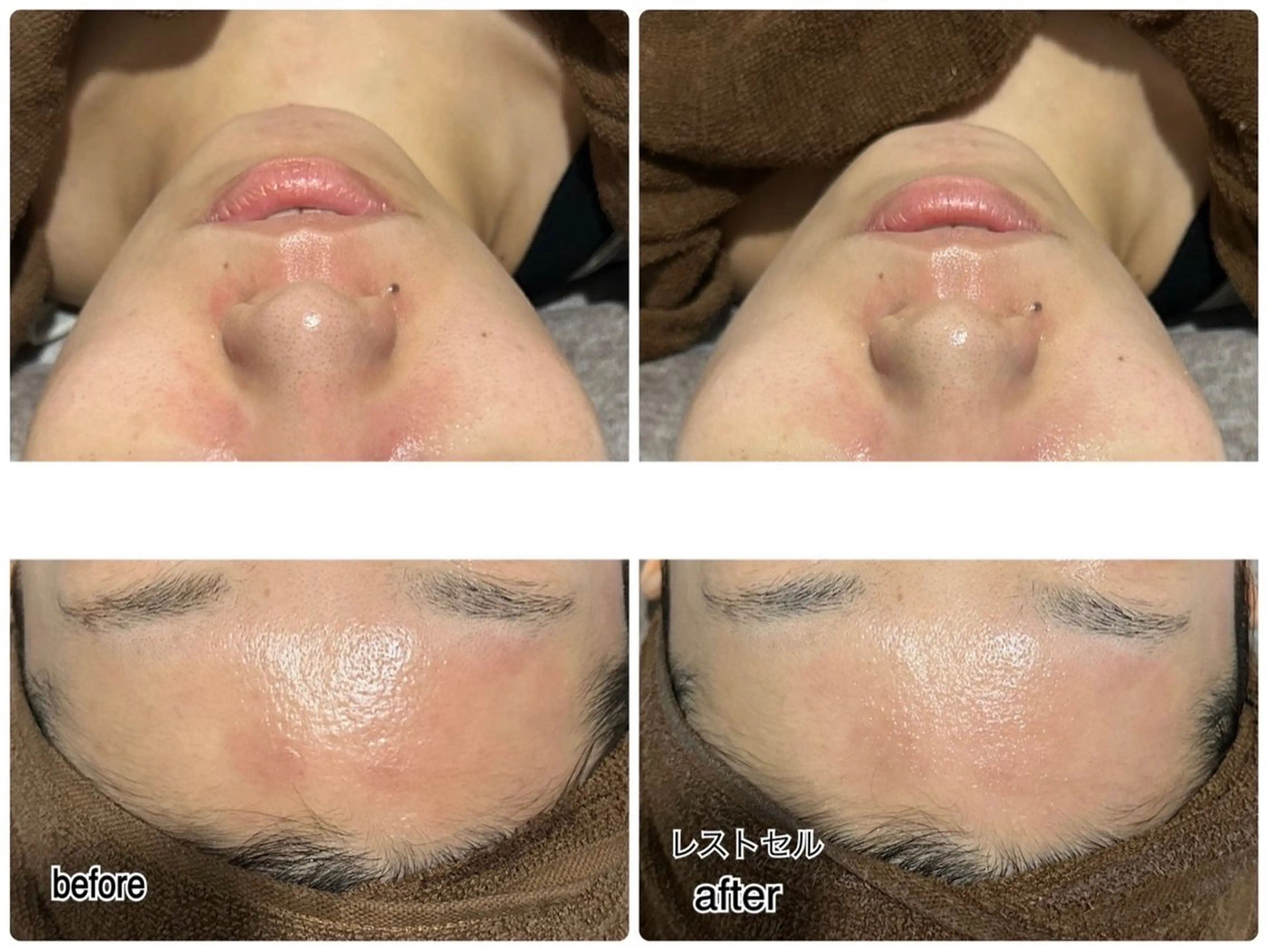 ENCHANT Kaede/肌質改善のその他イメージ