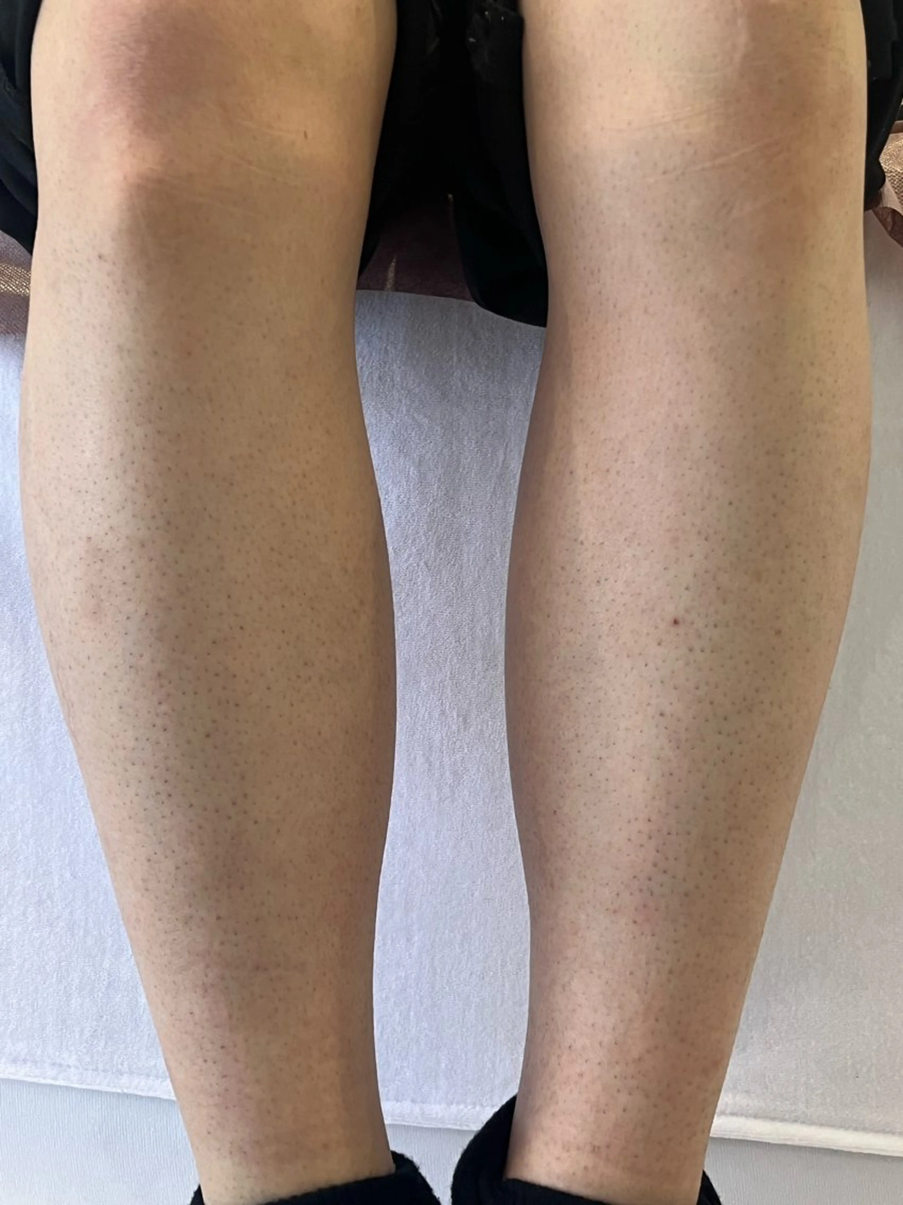 ［　］Shiro Meiのエステ・リラクイメージ