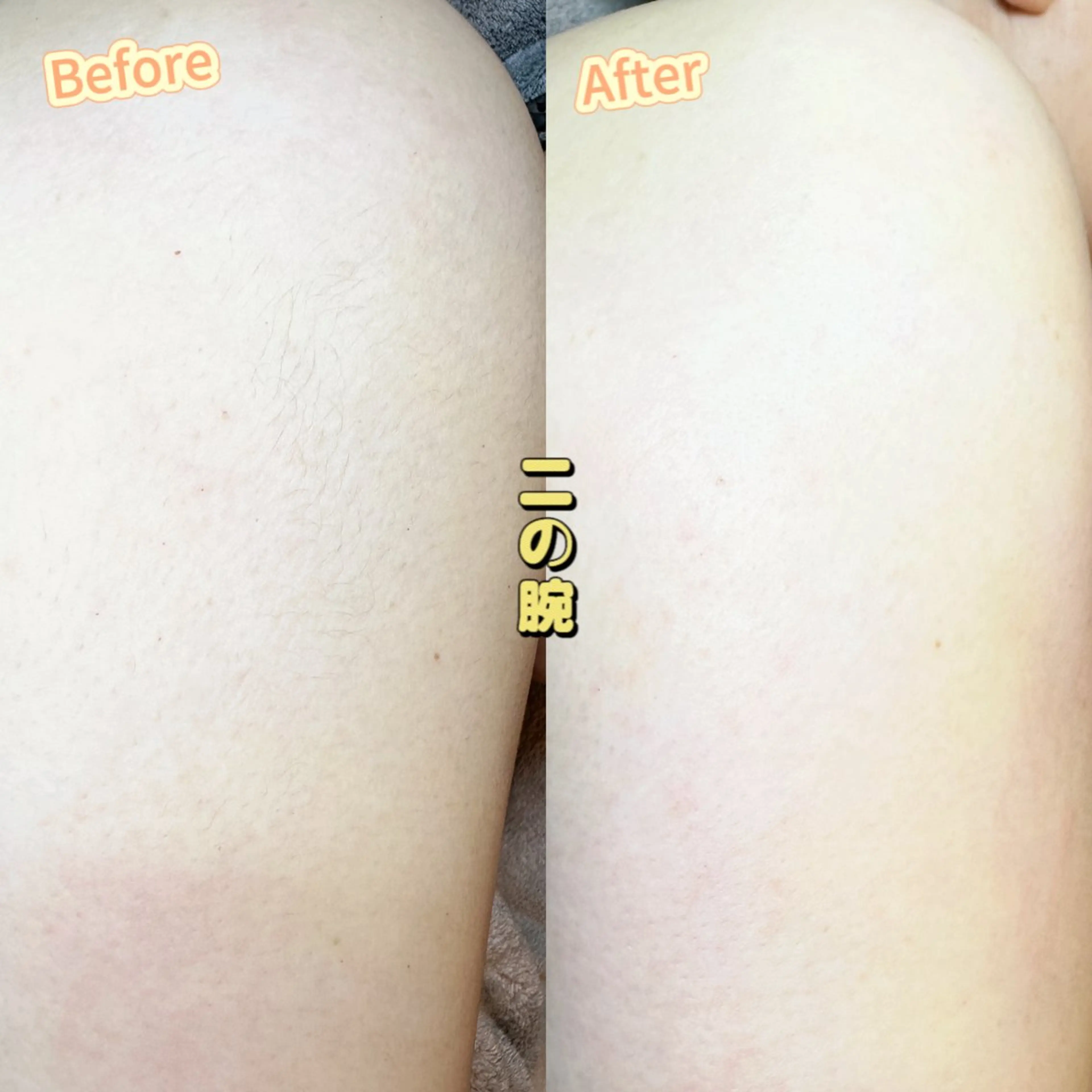 Hit. シュガーリング豊橋のエステ・リラクイメージ