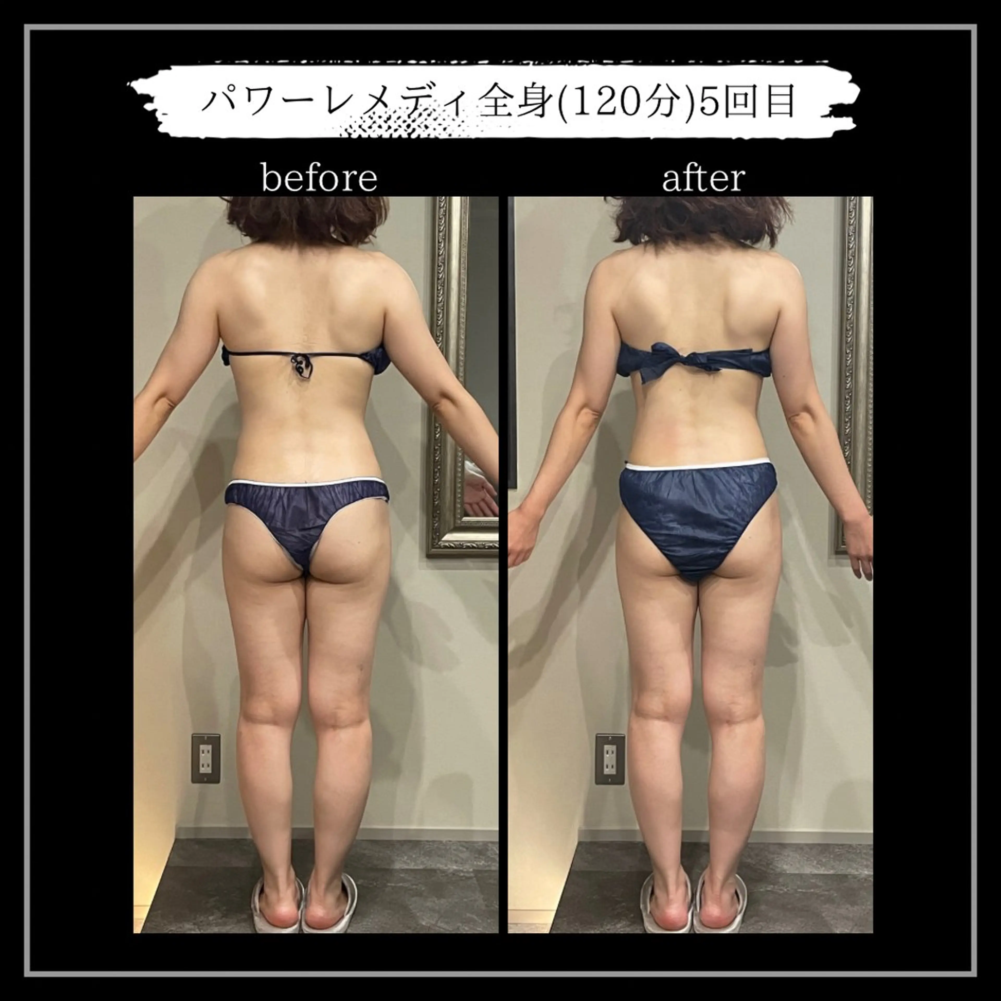 オフ:オン所属・オフ:オン 全身筋膜マッサージのエステ・リラクイメージ