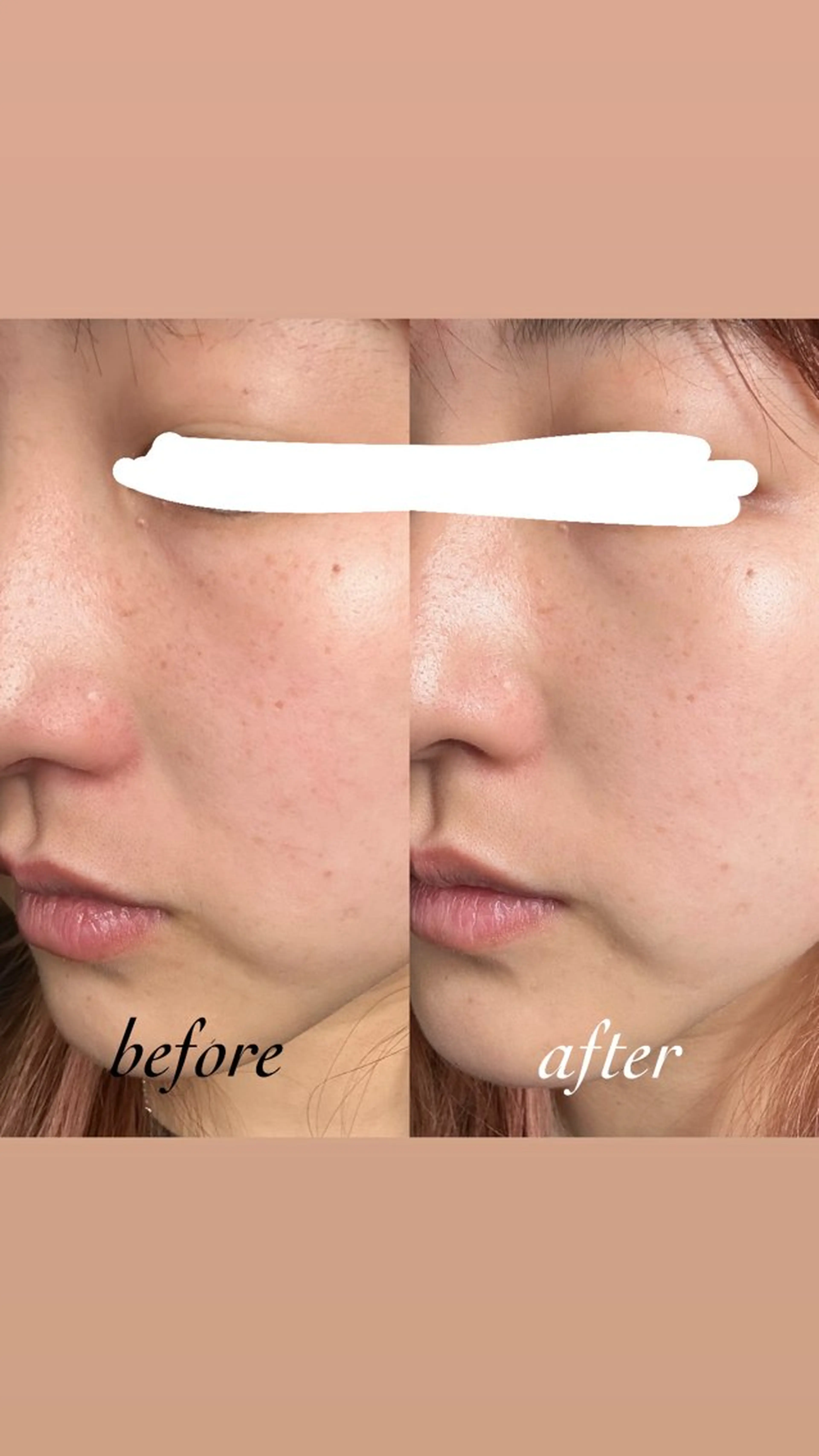 エステ pllia beautyのネイルデザイン