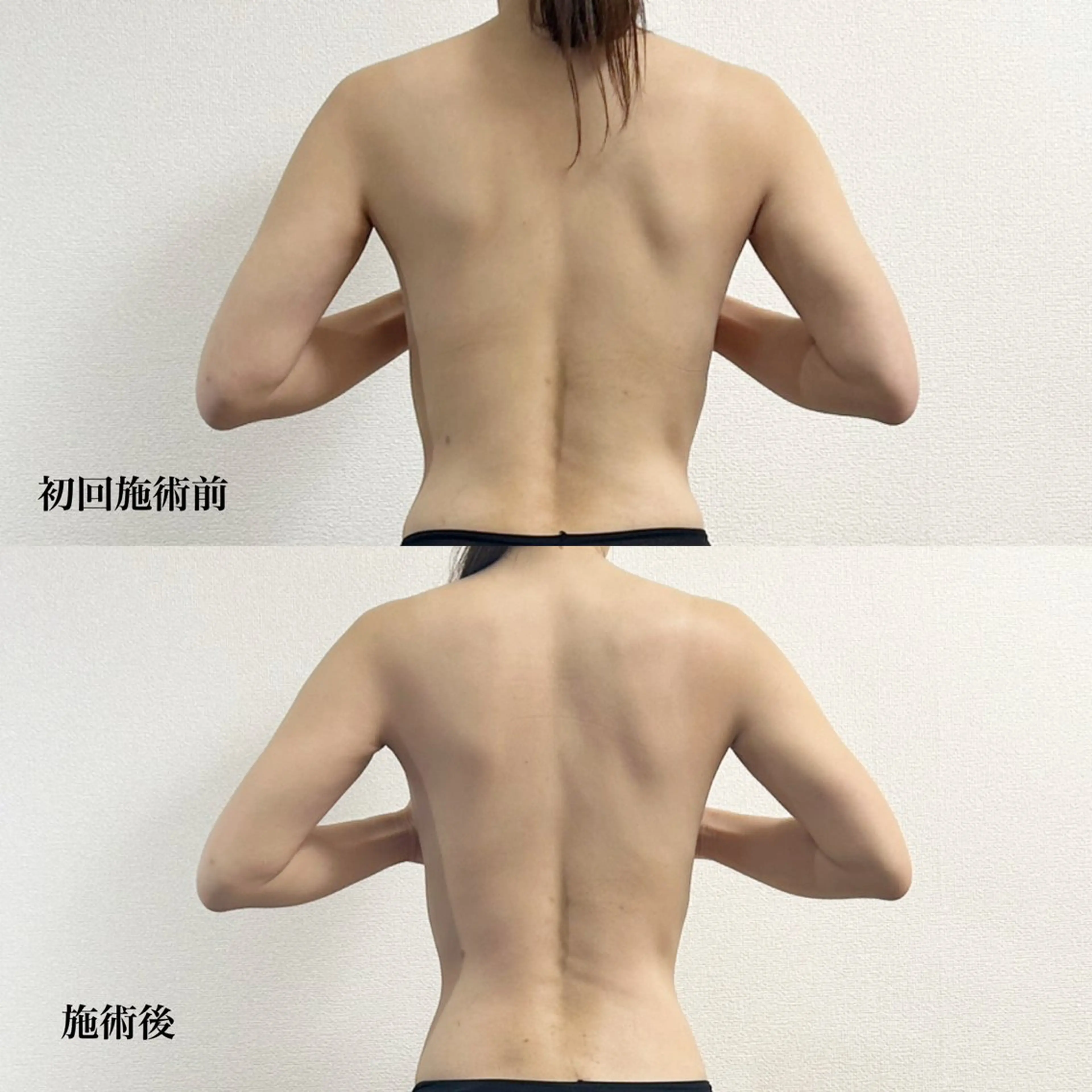 リピート率No.1！【骨格から変わる】姿勢改善x筋膜リリース美骨150分コース　¥16,500の写真