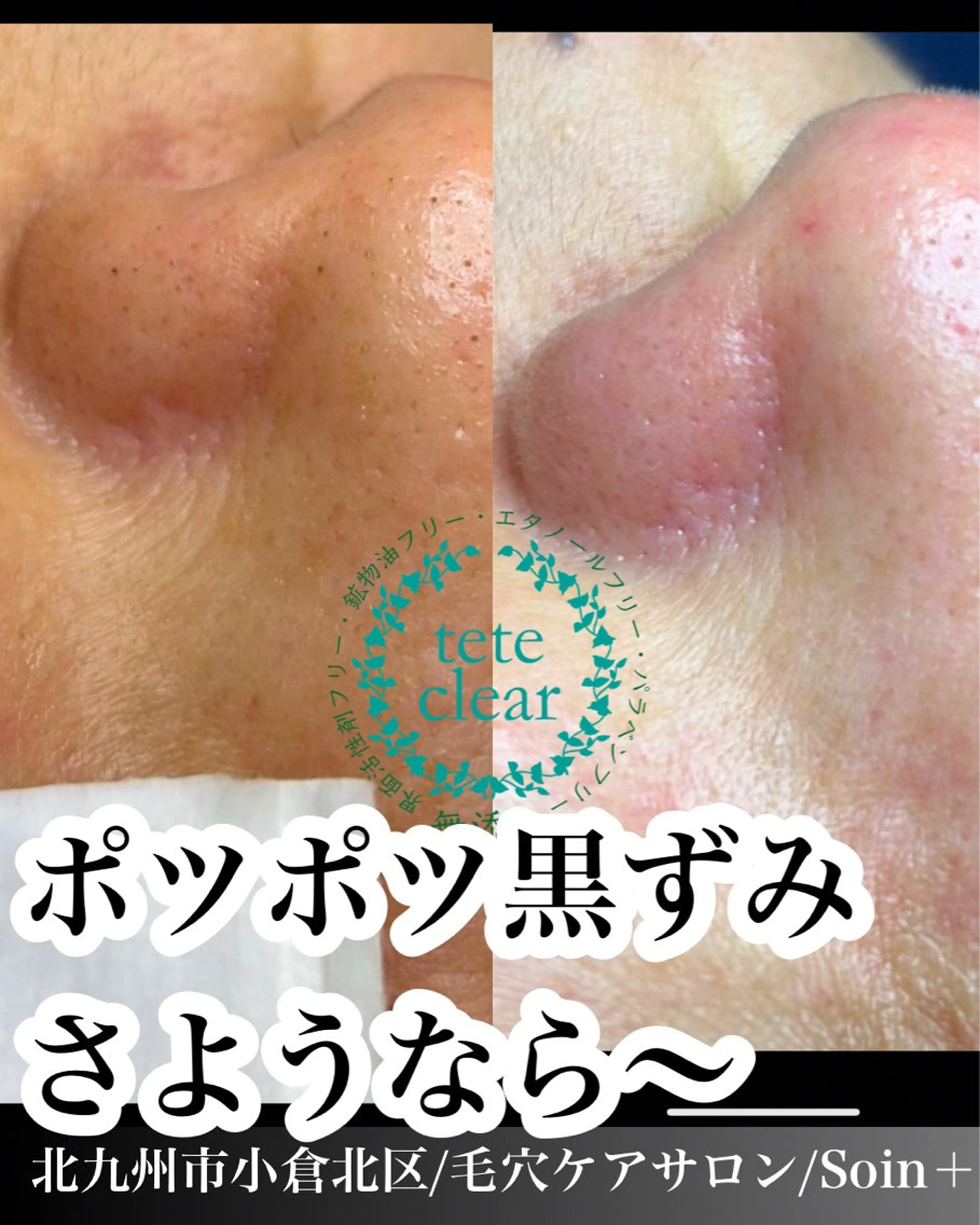 エステ Soin＋ みきのエステ・リラクイメージ