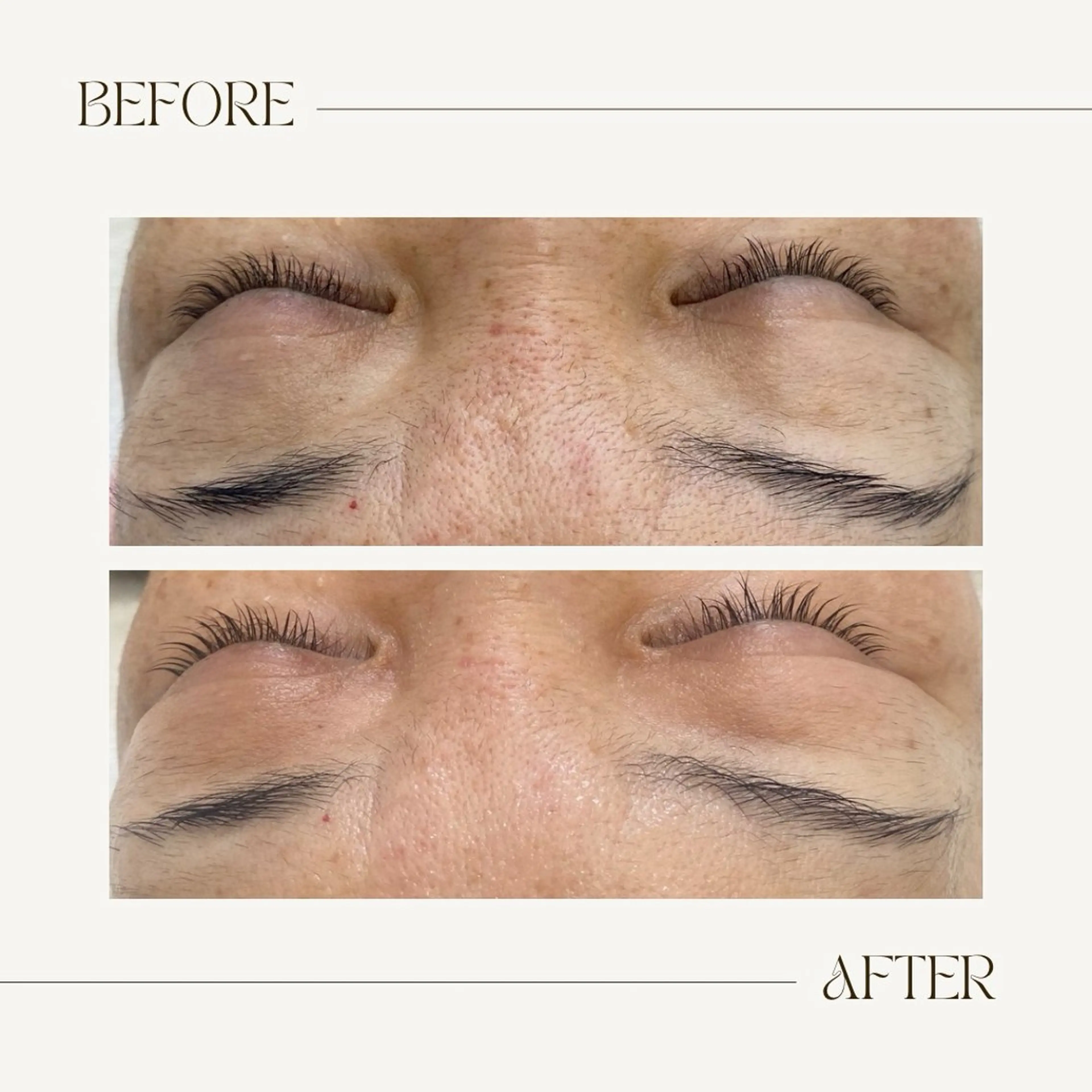 CEsalonEgg 齋藤のエステ・リラクイメージ