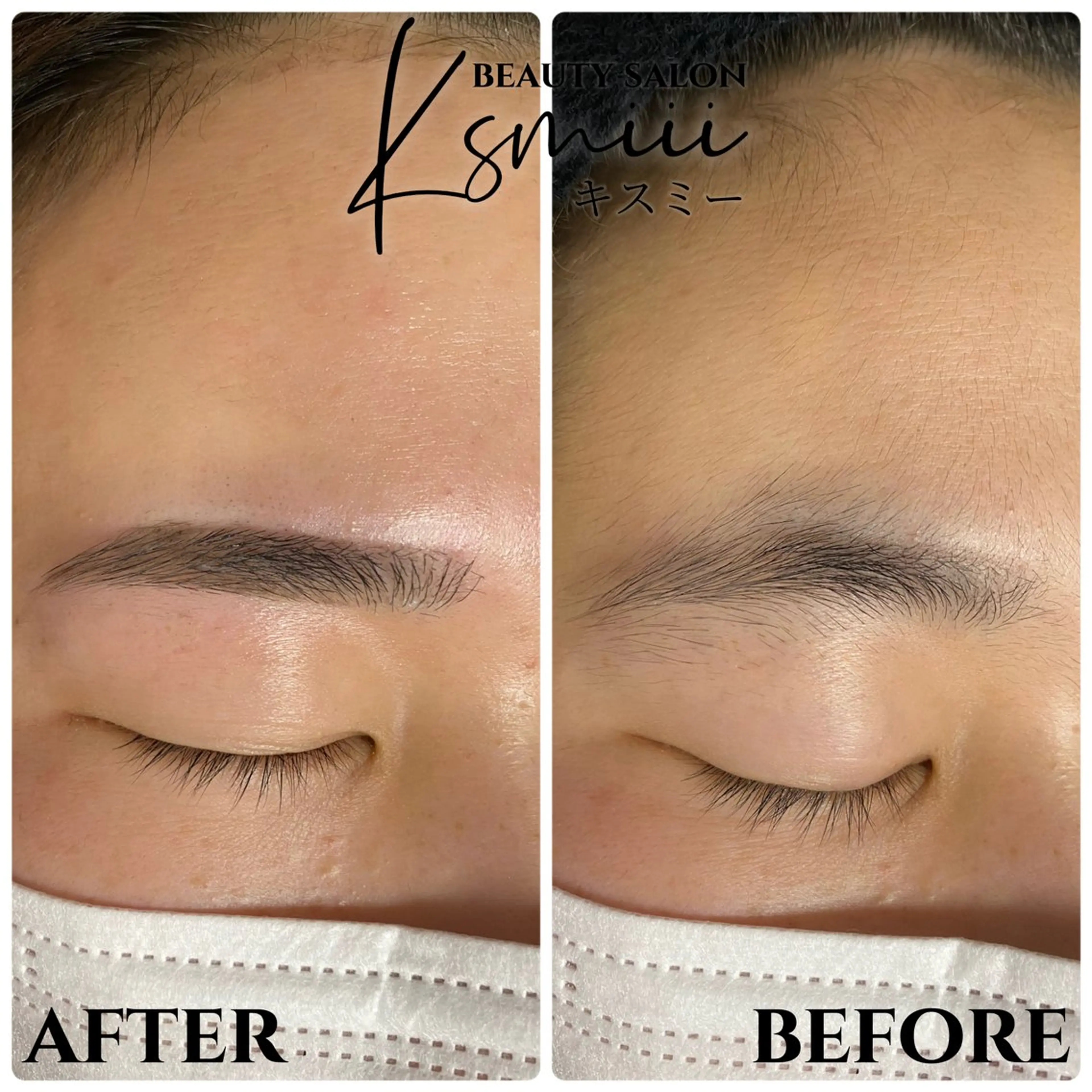 美眉スタイリング×おでこWAX脱毛の写真