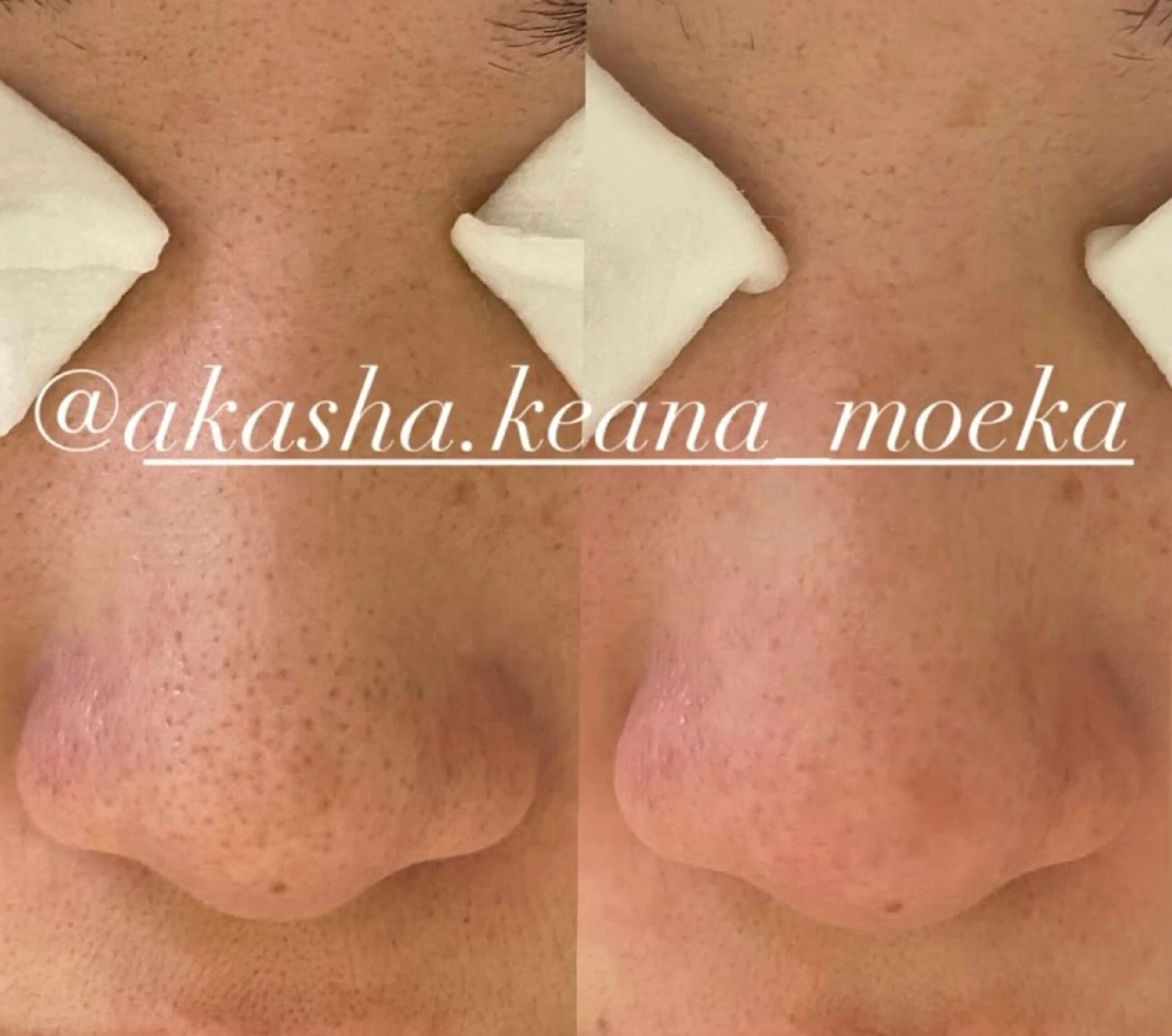 エステ akasha所属・渡部 ゆみのエステ・リラクイメージ