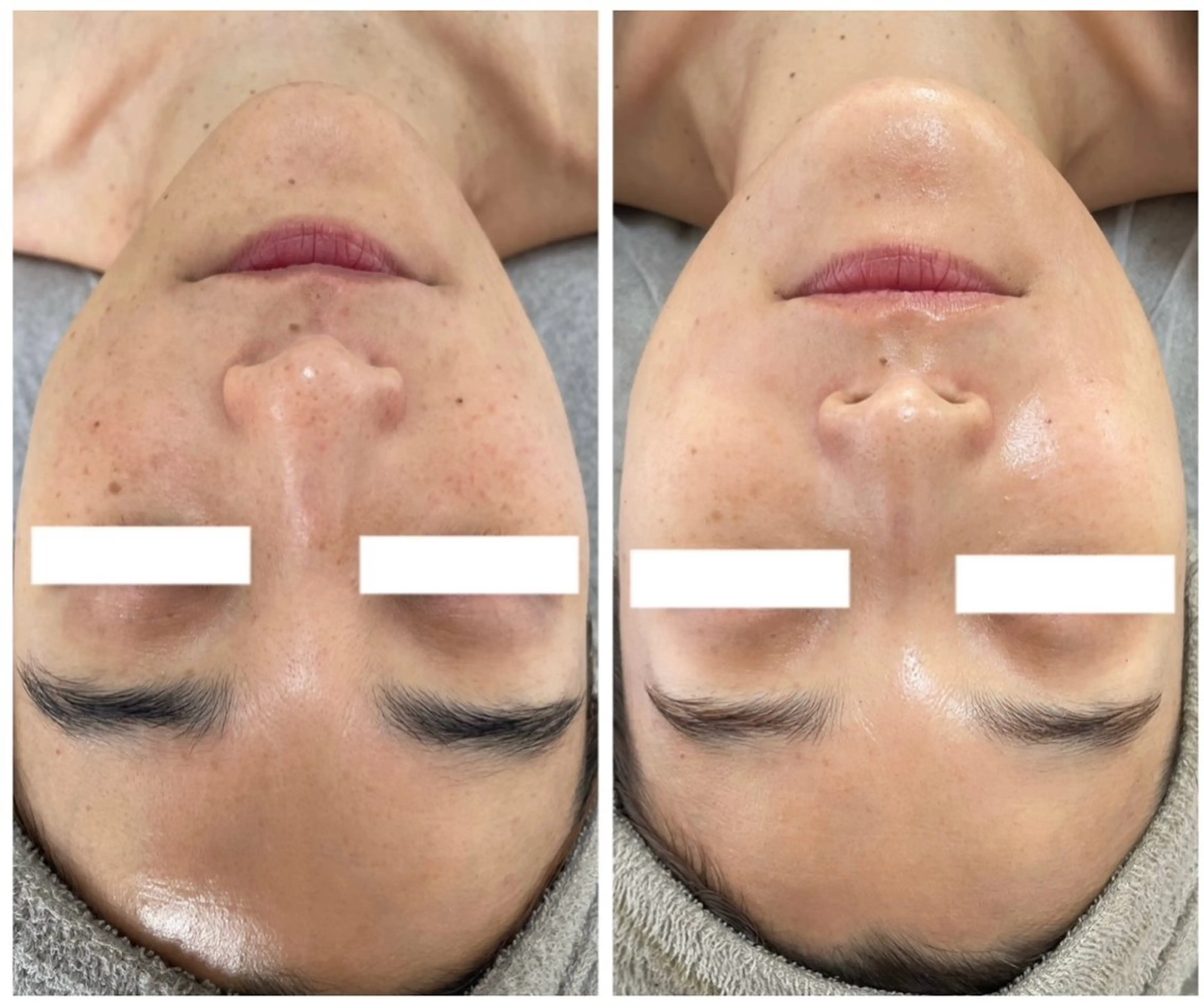 エステ Esthe salon Blanche(エステサロンブランシュ)所属・小顔リフトアップ 美肌改善専門店のエステ・リラクイメージ