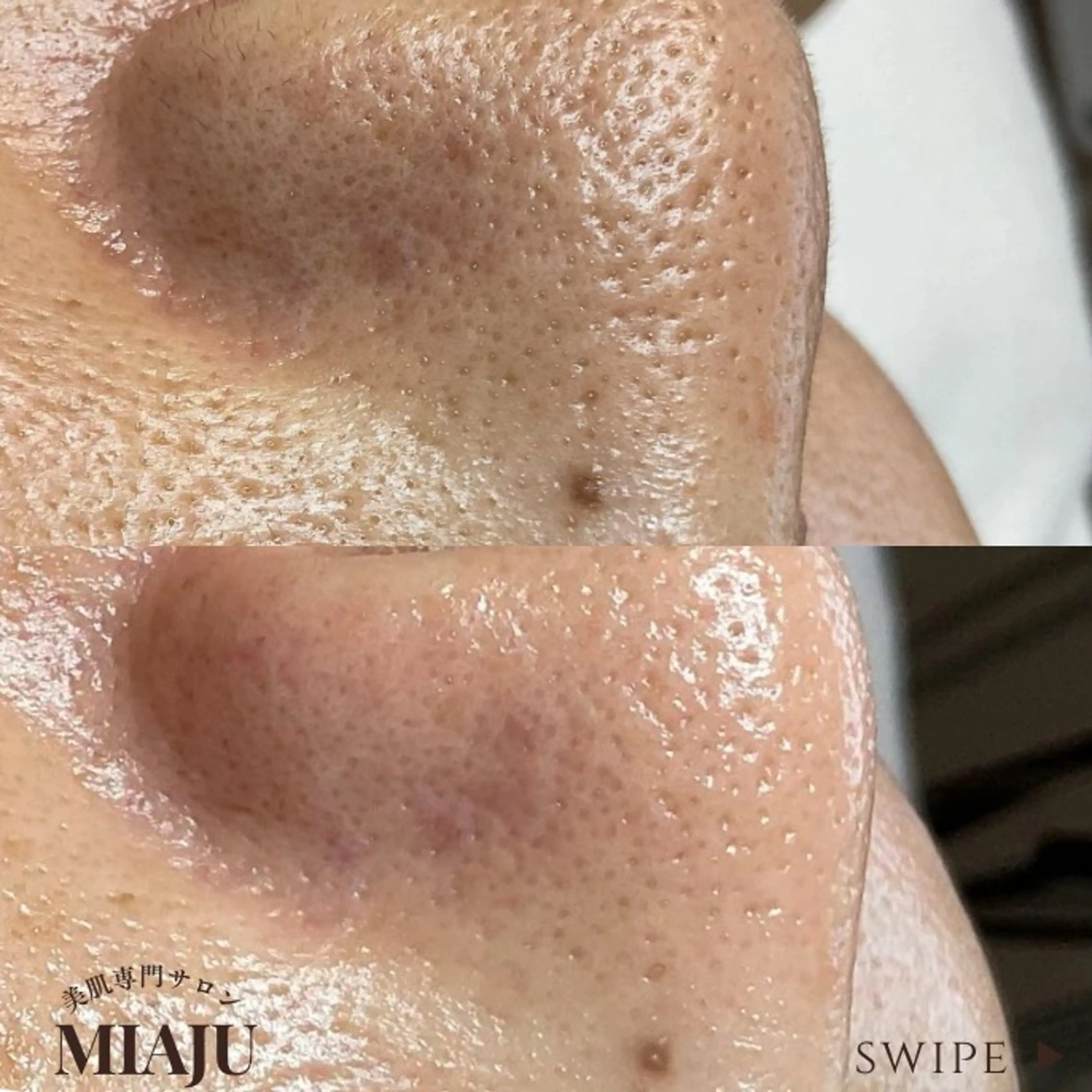 美肌専門サロン MIAJUのエステ・リラクイメージ