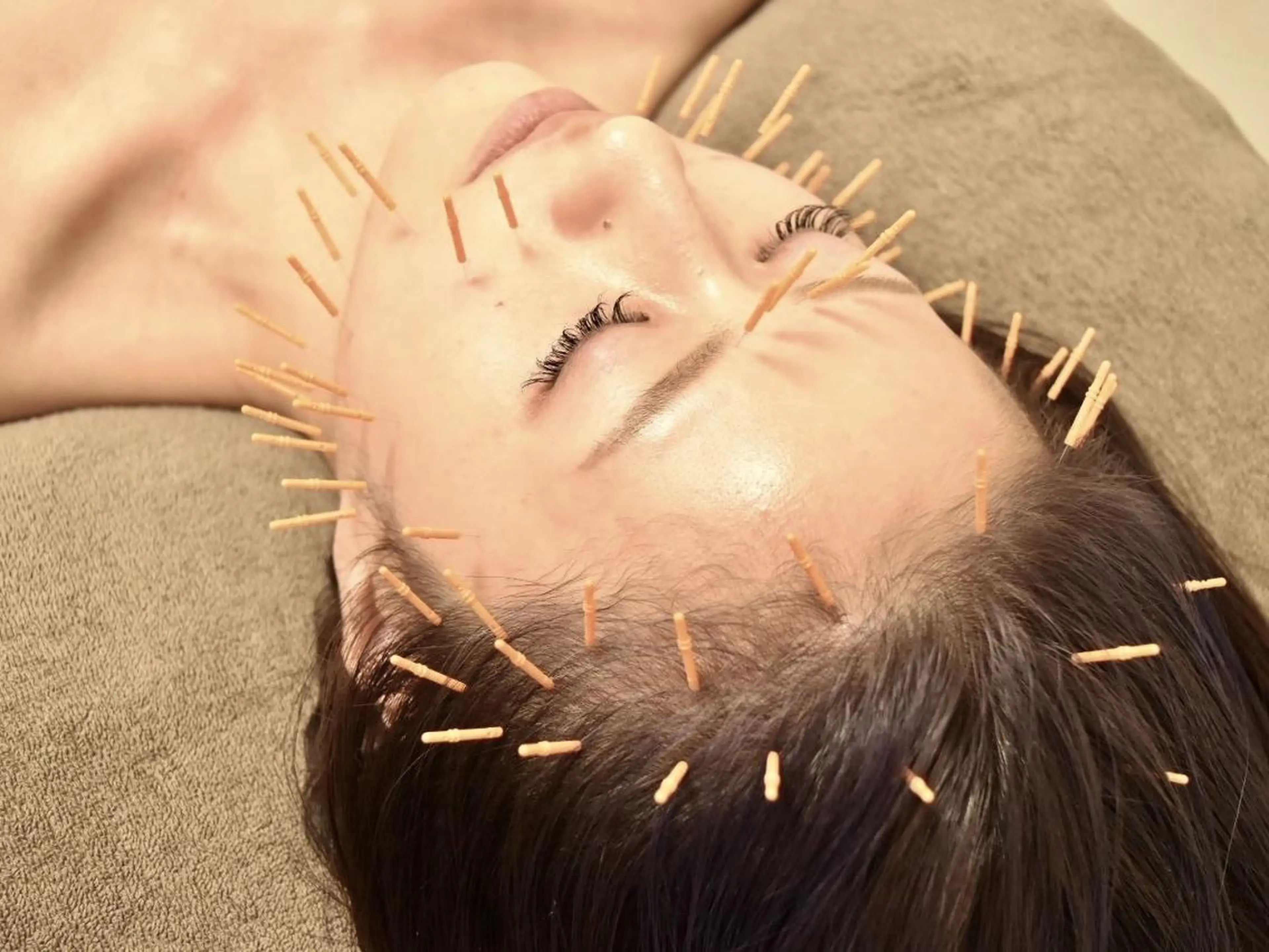 【新規】【選べる】美顔鍼フェイシャル＋ヒト幹orプラセンタ 50分¥15400→¥6990の写真