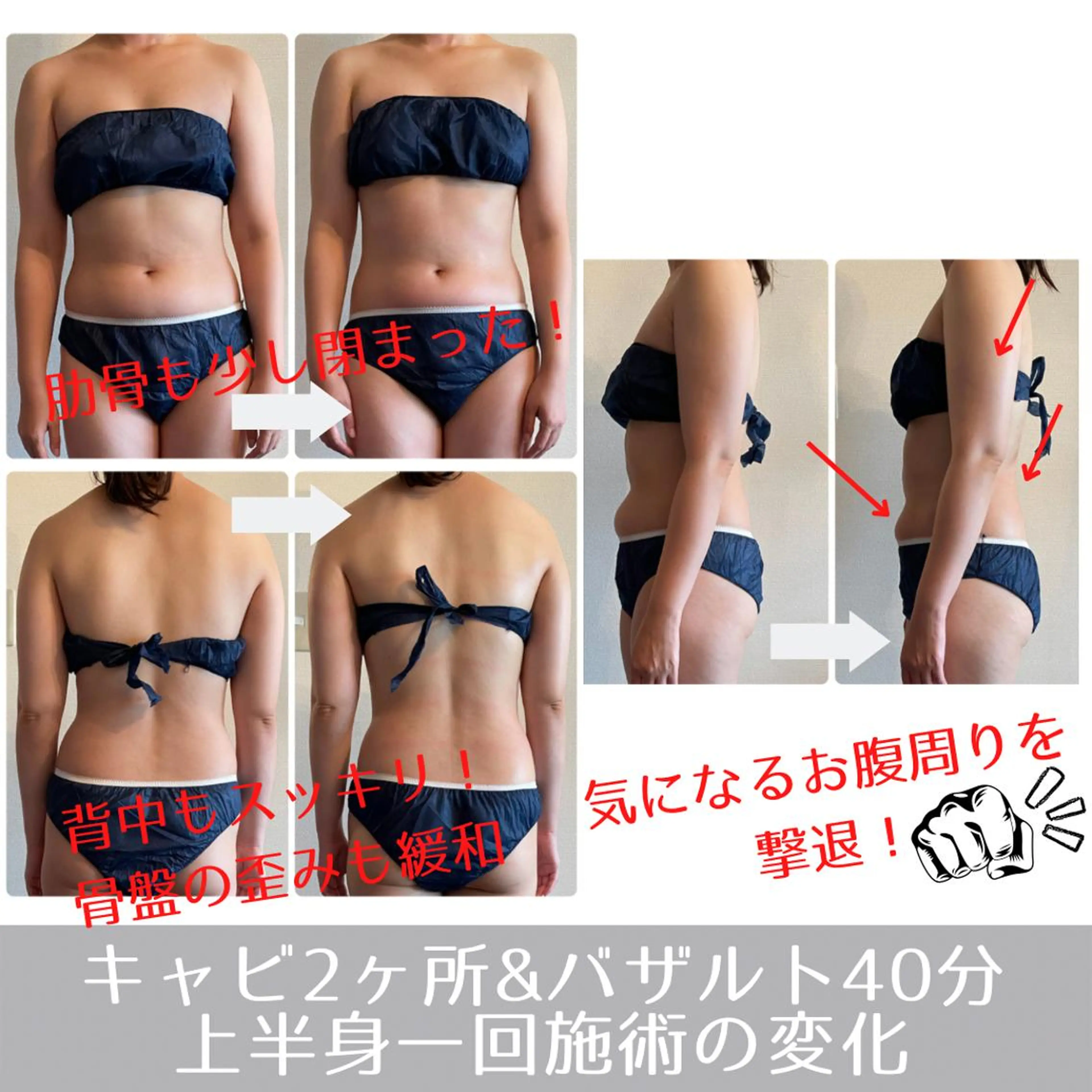 【下半身or上半身モニター】キャビ&EMS＋むくみ撃退バザルトで美脚へ！の写真