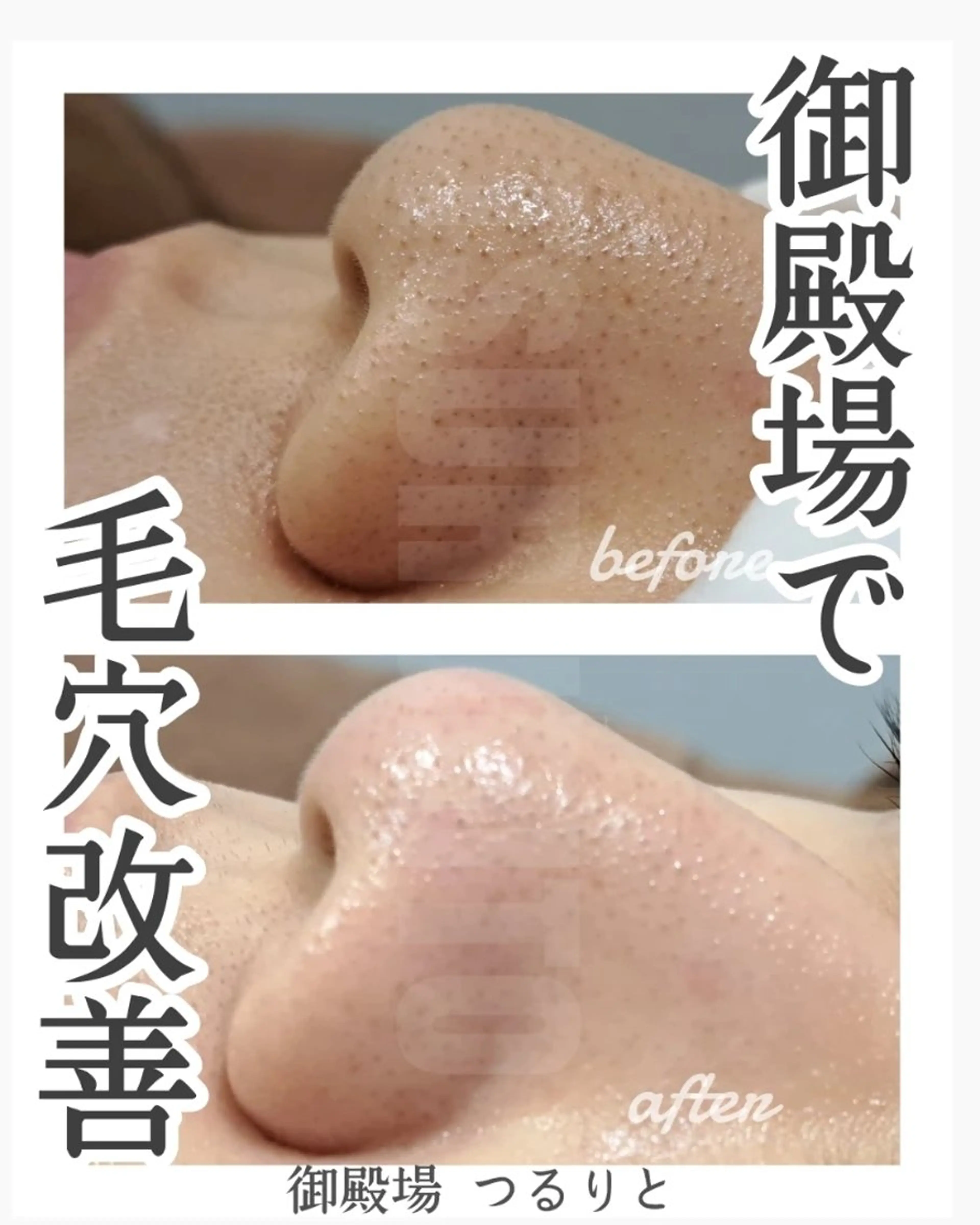 美肌脱毛サロン つるりと御殿場店所属・美肌脱毛サロン つるりとのその他イメージ