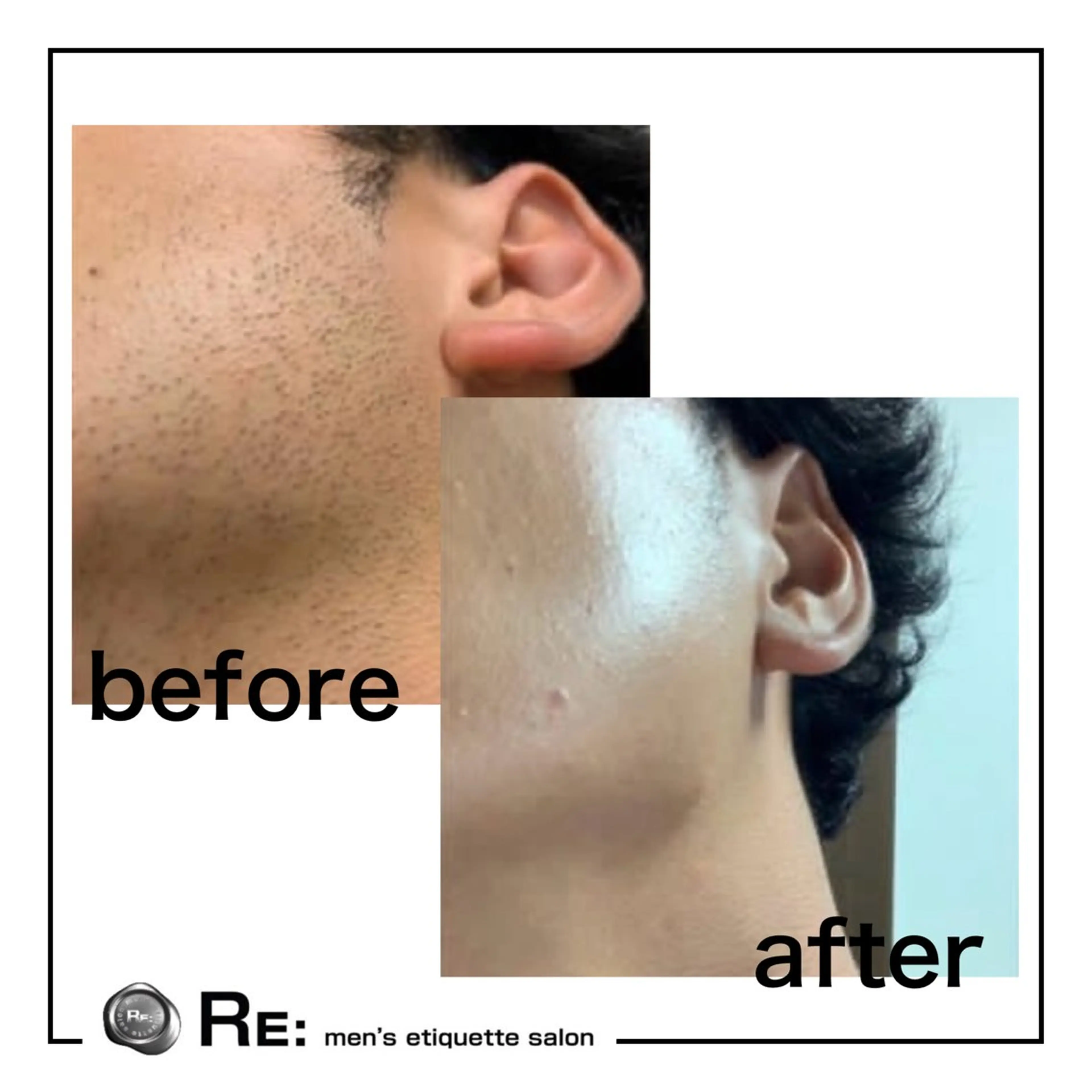 脱毛 【都度払い脱毛】 RE:  桜木町店のエステ・リラクイメージ