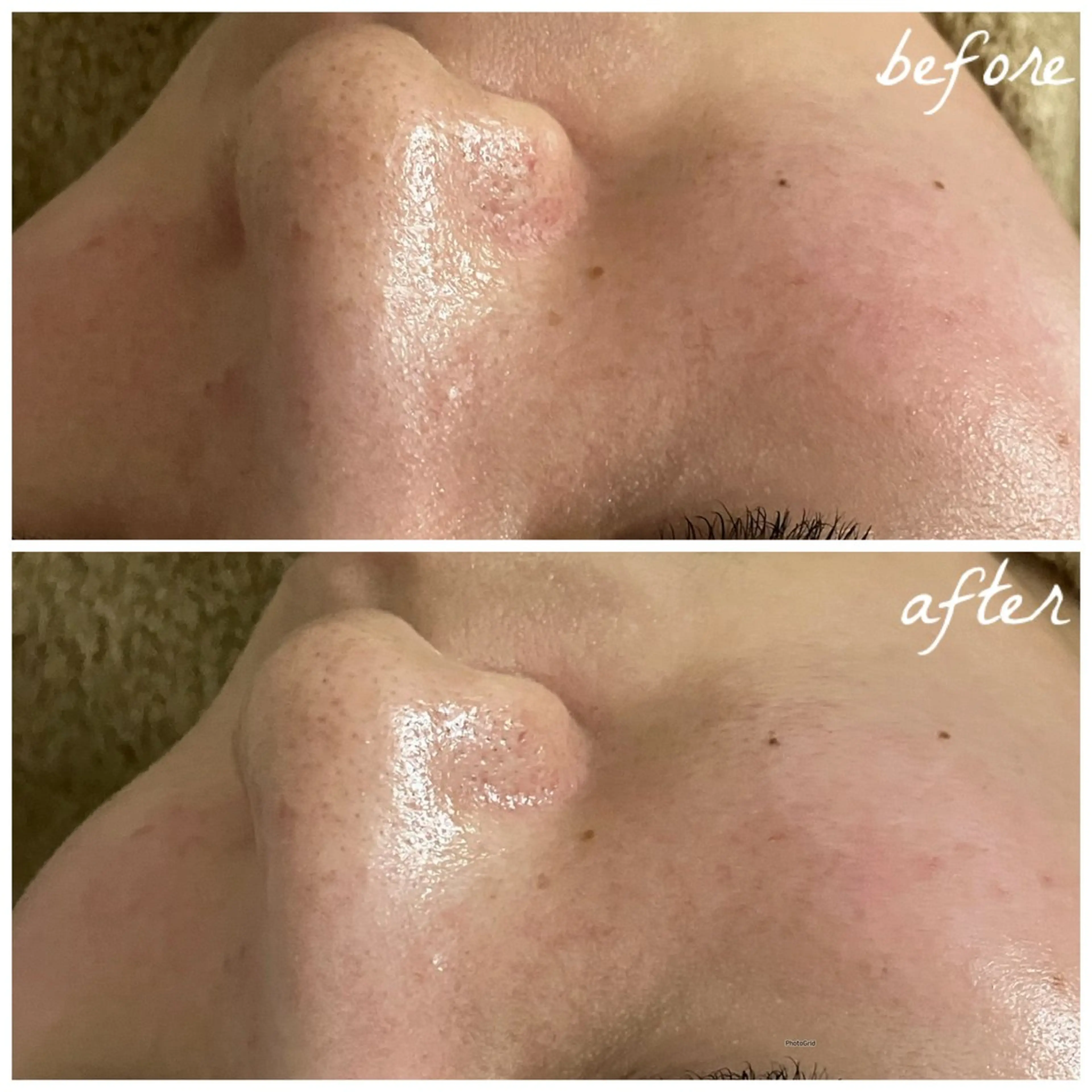 メンズ エステ メナード岐阜茜部 杉浦のエステ・リラクイメージ