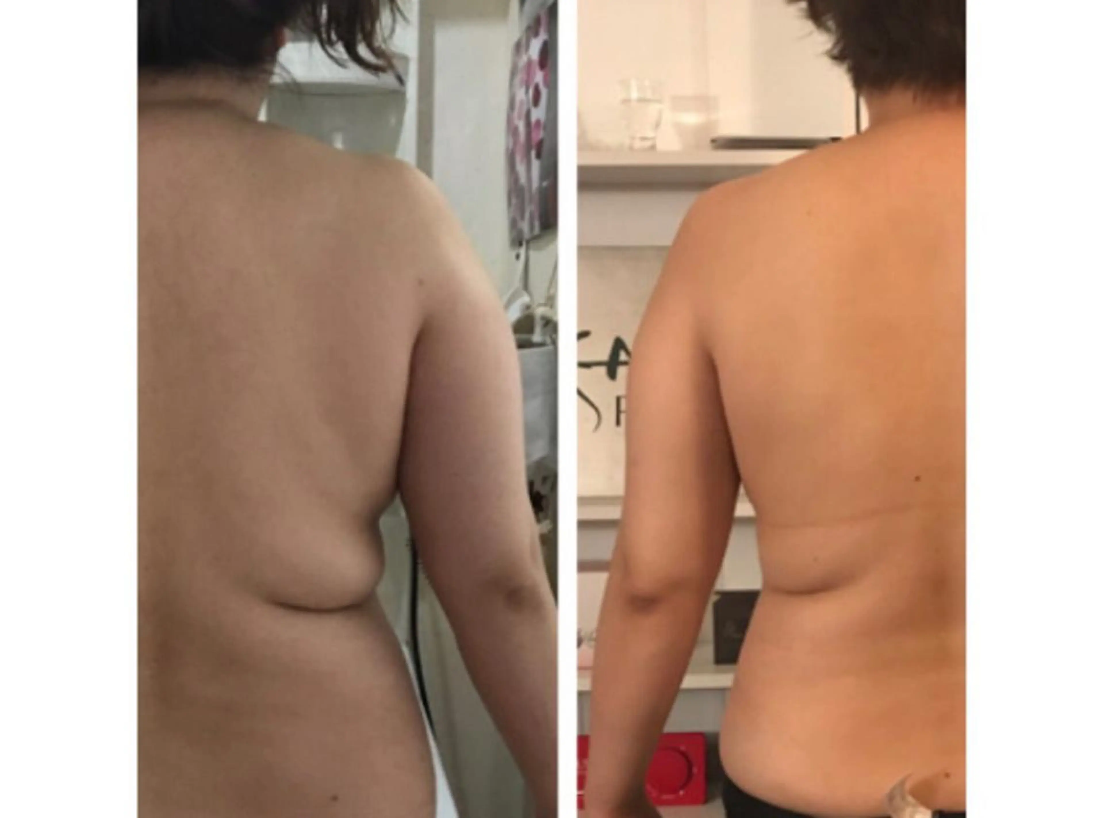 エステ リラク YOSAPARK Lino.大分駅前店のエステ・リラクイメージ