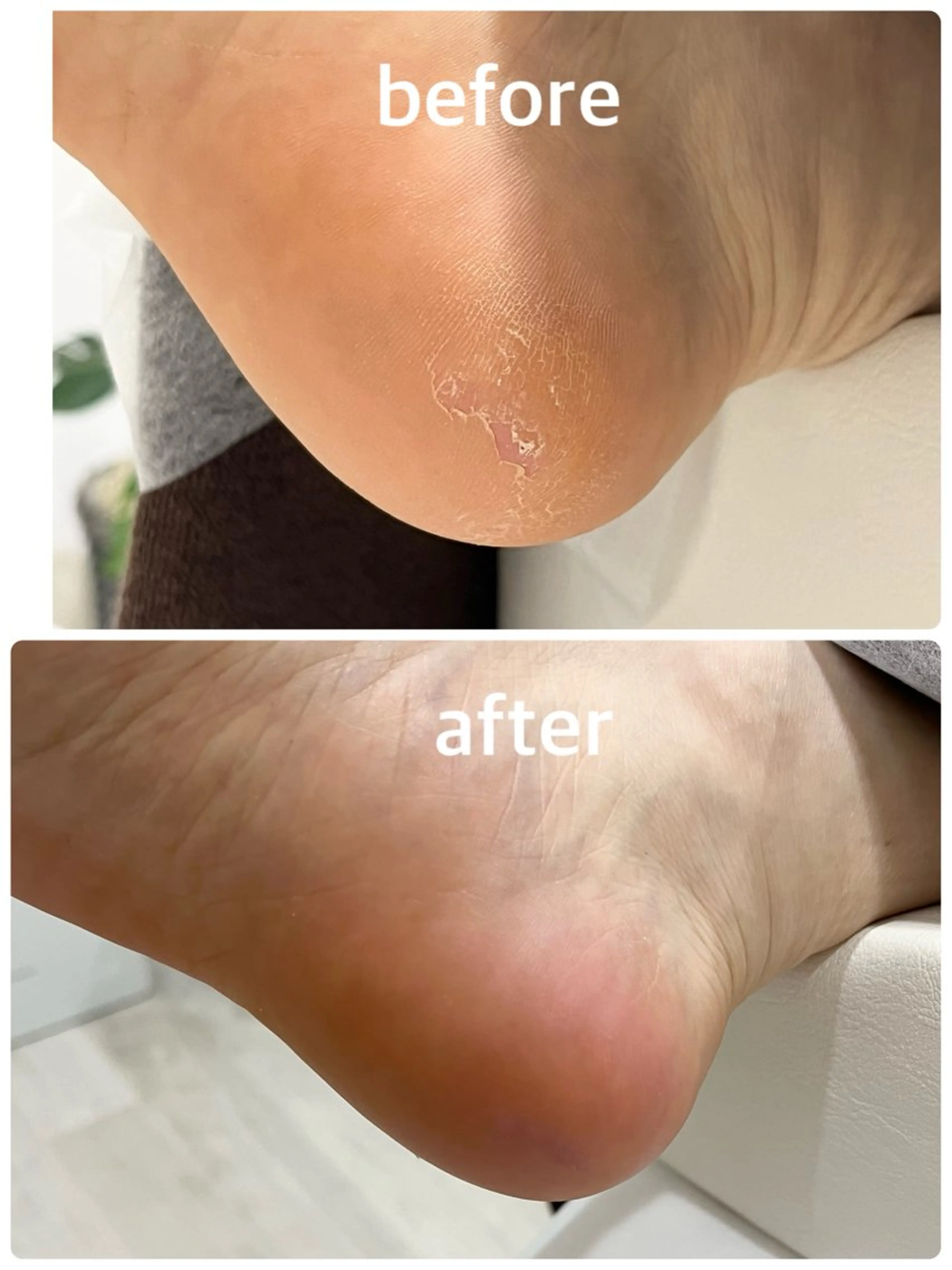 リラク 足・爪トラブル専門店　foot grace所属・加藤 望のネイルデザイン