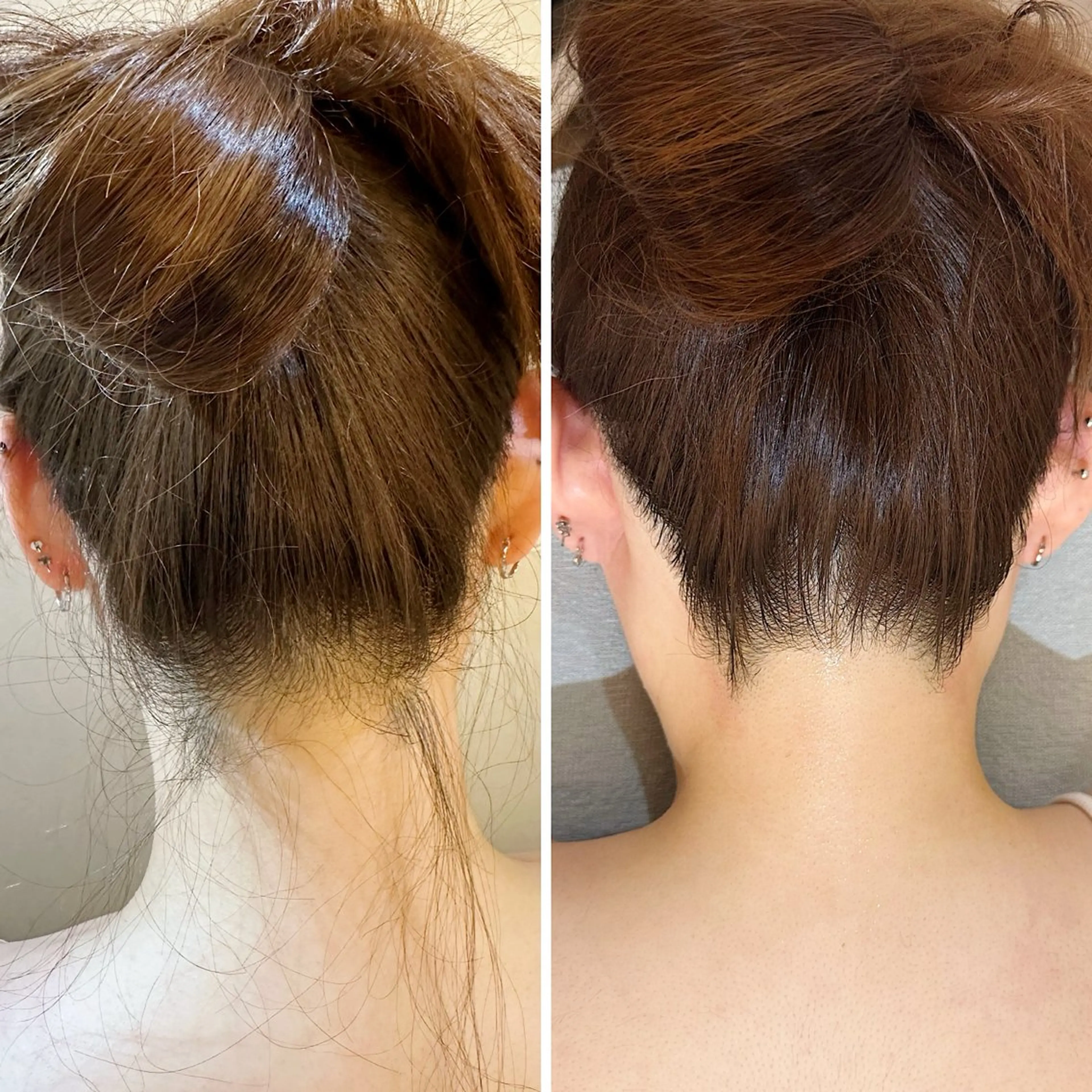 脱毛 うなじ脱毛/美肌脱毛 LABELのエステ・リラクイメージ