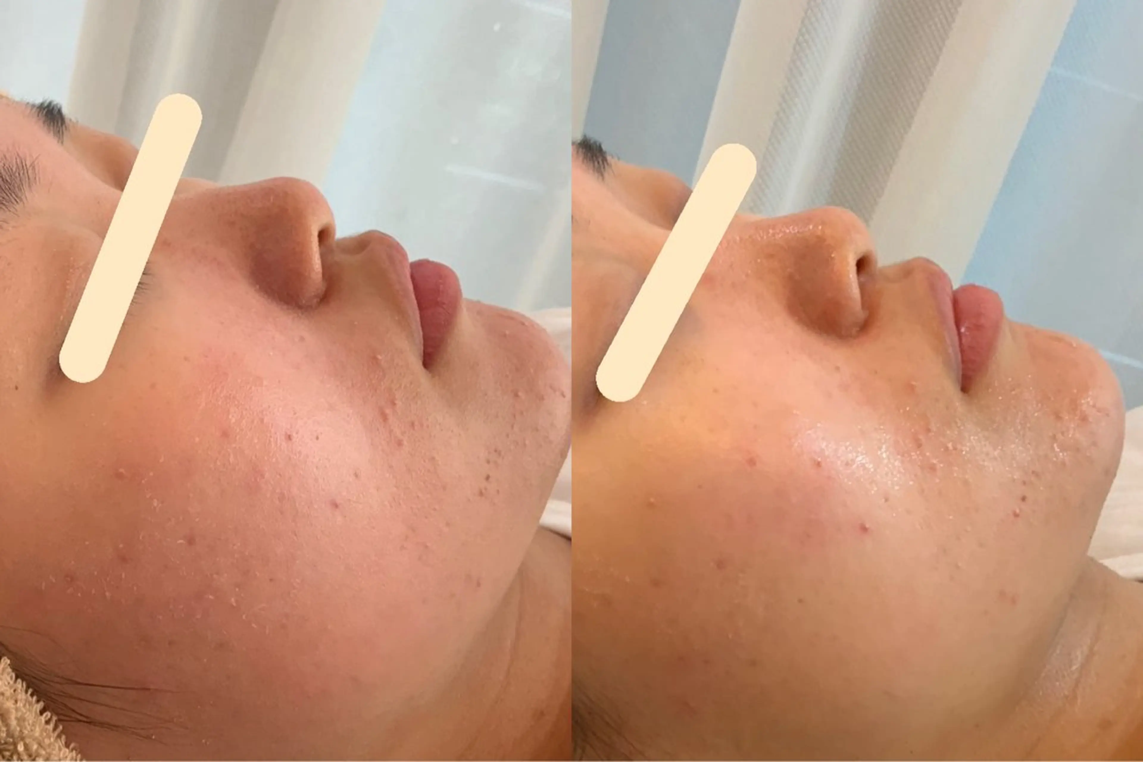 エステ 最速小顔・肌質管理 ❣️エスポワールのエステ・リラクイメージ