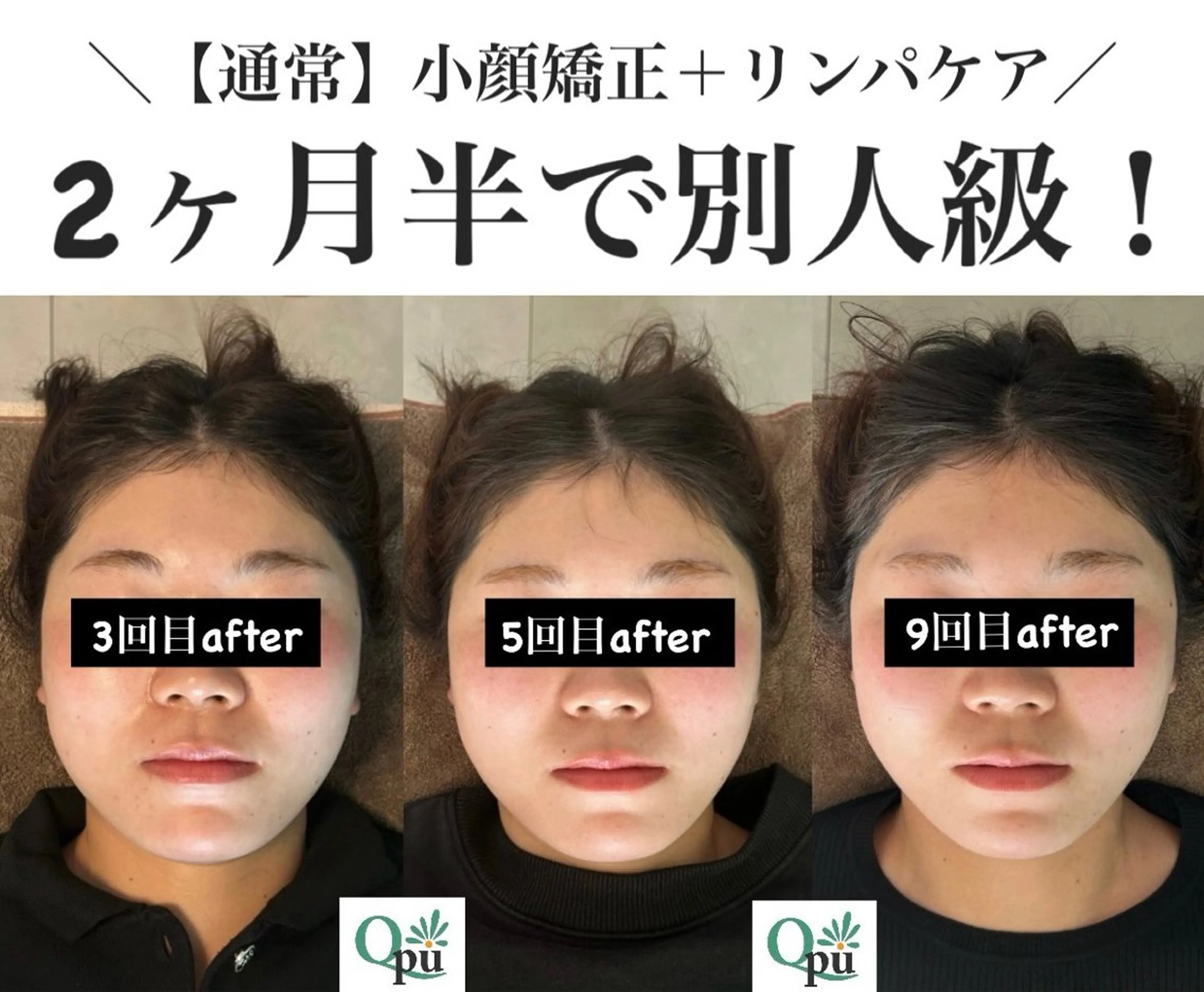 Qpu(キュープ)下北沢店所属・鮎川 さゆりのエステ・リラクイメージ