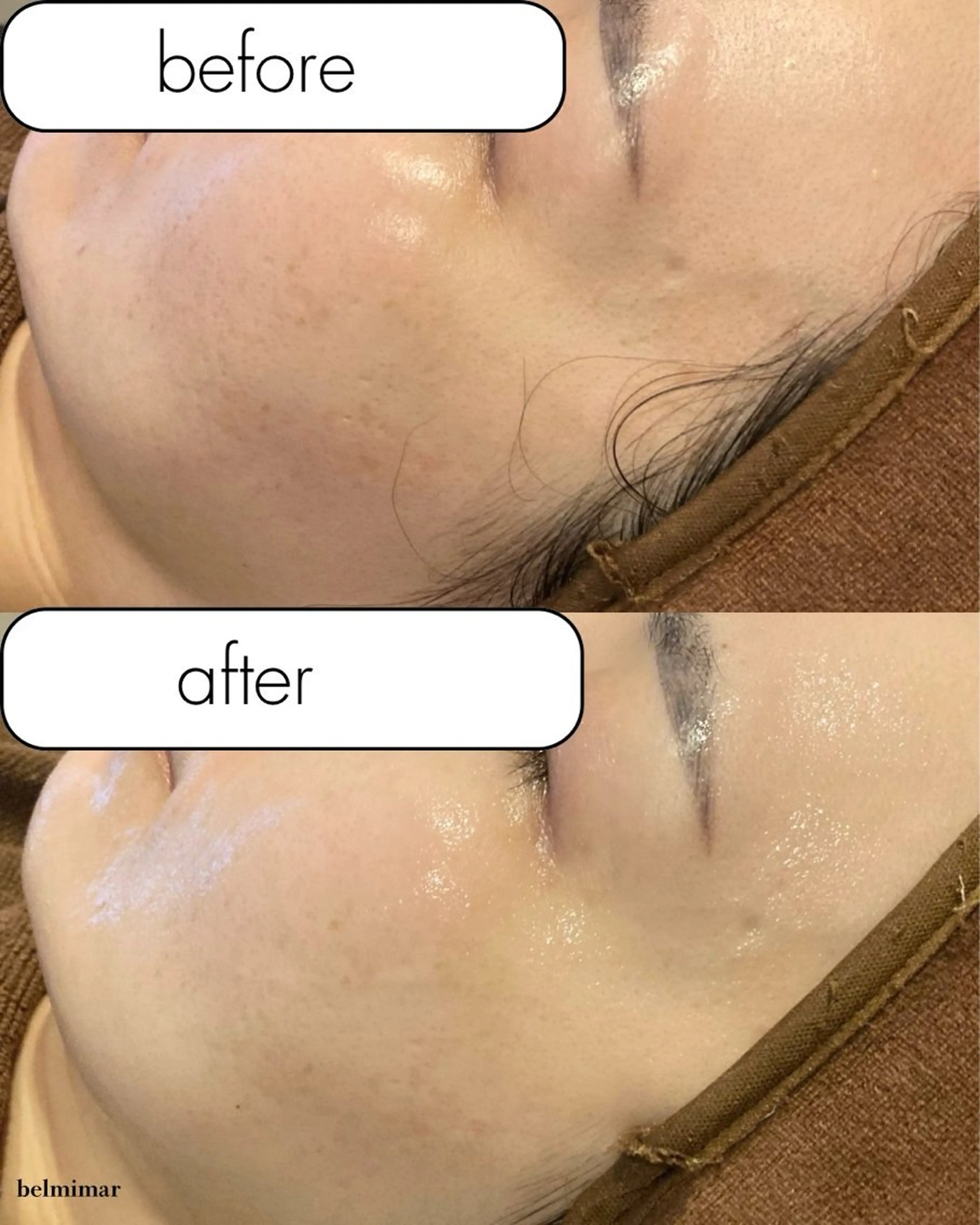 南森町・肌質改善 BELMIMARのエステ・リラクイメージ