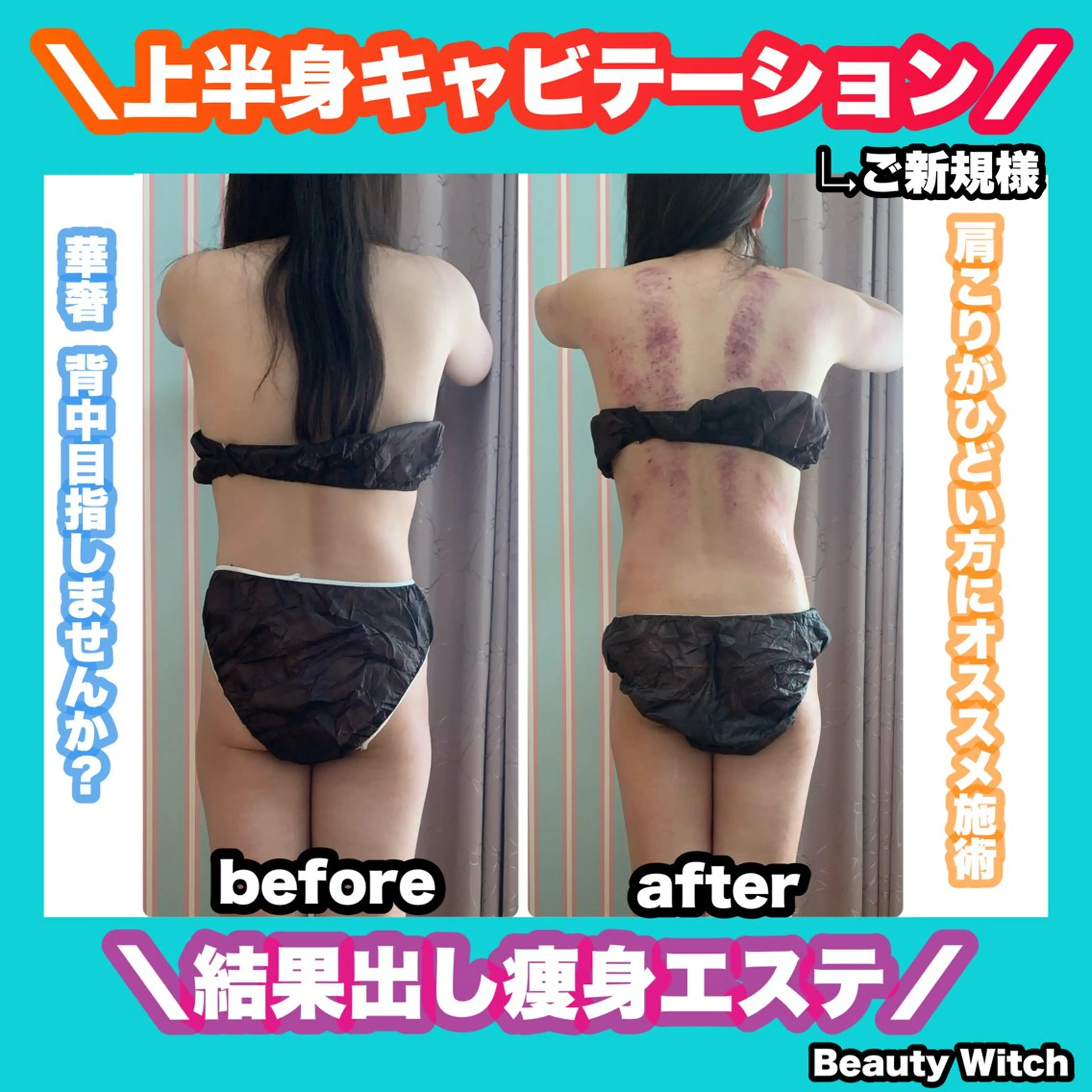 エステ リラク 痩身/脱毛/ネイル HARUKAのエステ・リラクイメージ